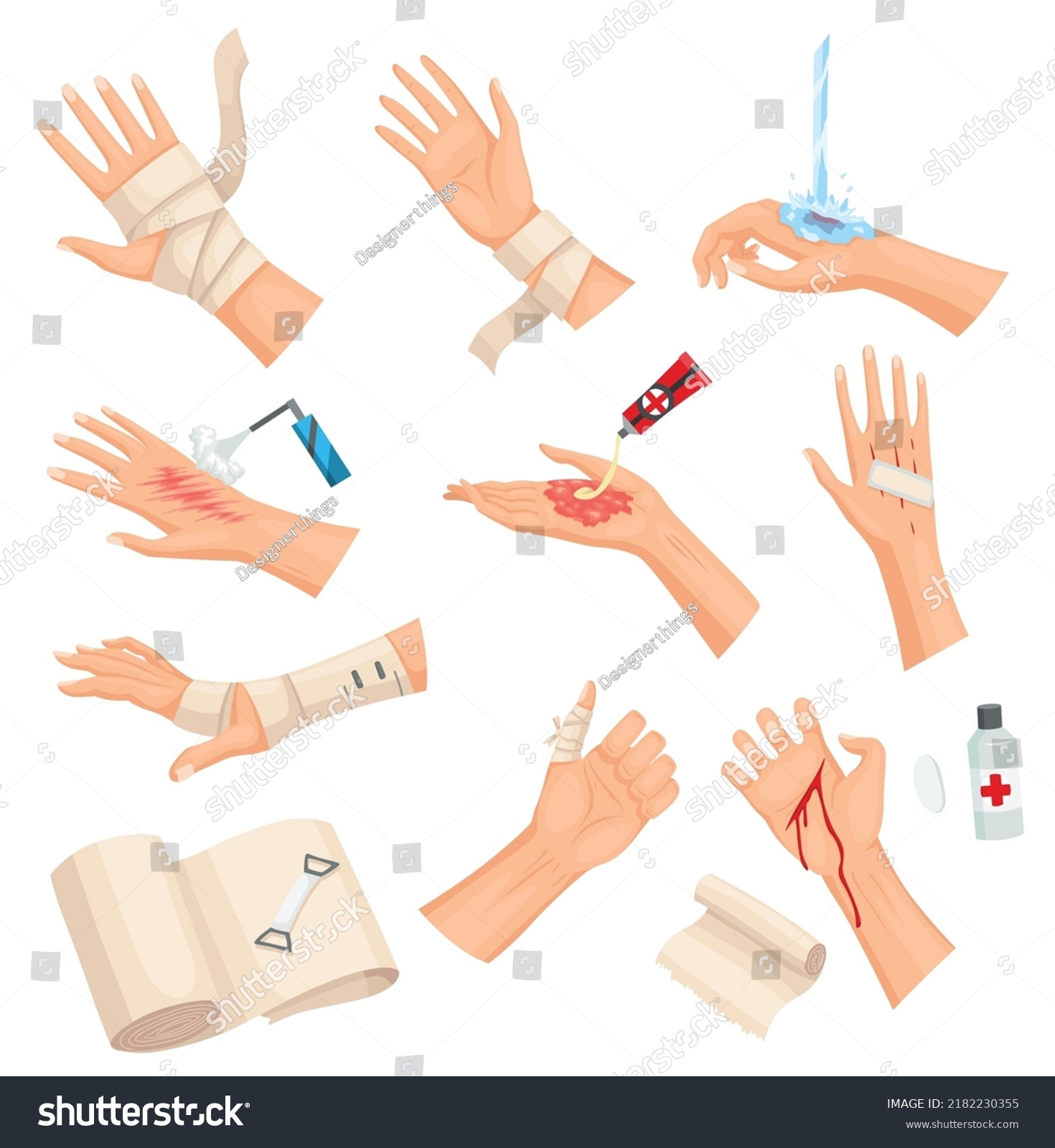 Hands Injured Skin Procedures Bandaging Wound Stock Vector (Royalty ...