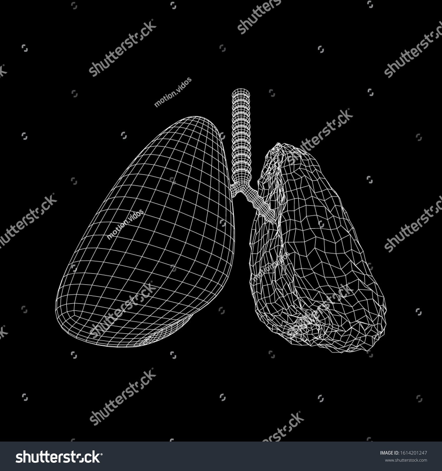 Healthy Sick Lung Trachea Bronchi Internal Stock Vector Royalty Free