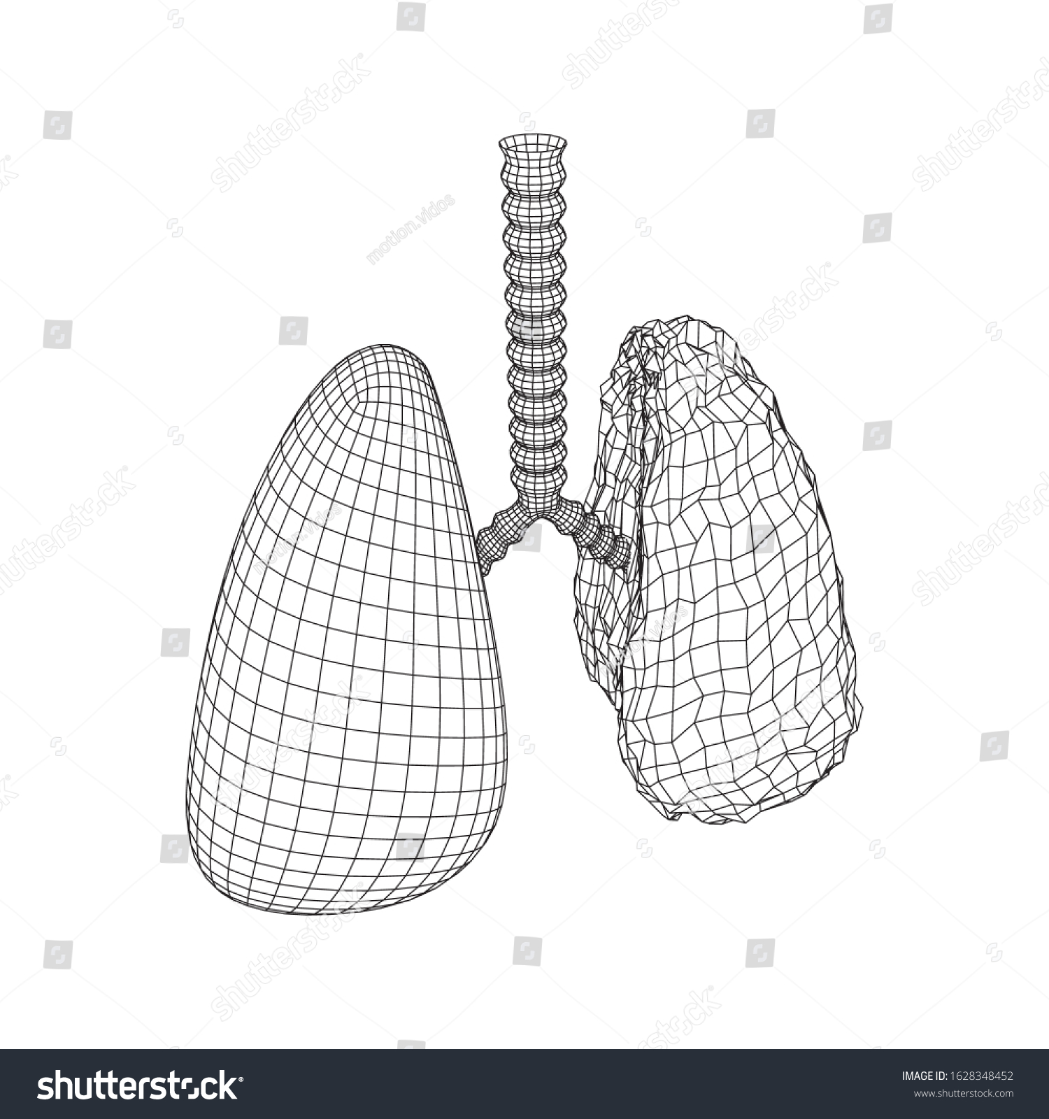 Healthy Sick Lung Trachea Bronchi Internal Stock Vektorgrafik