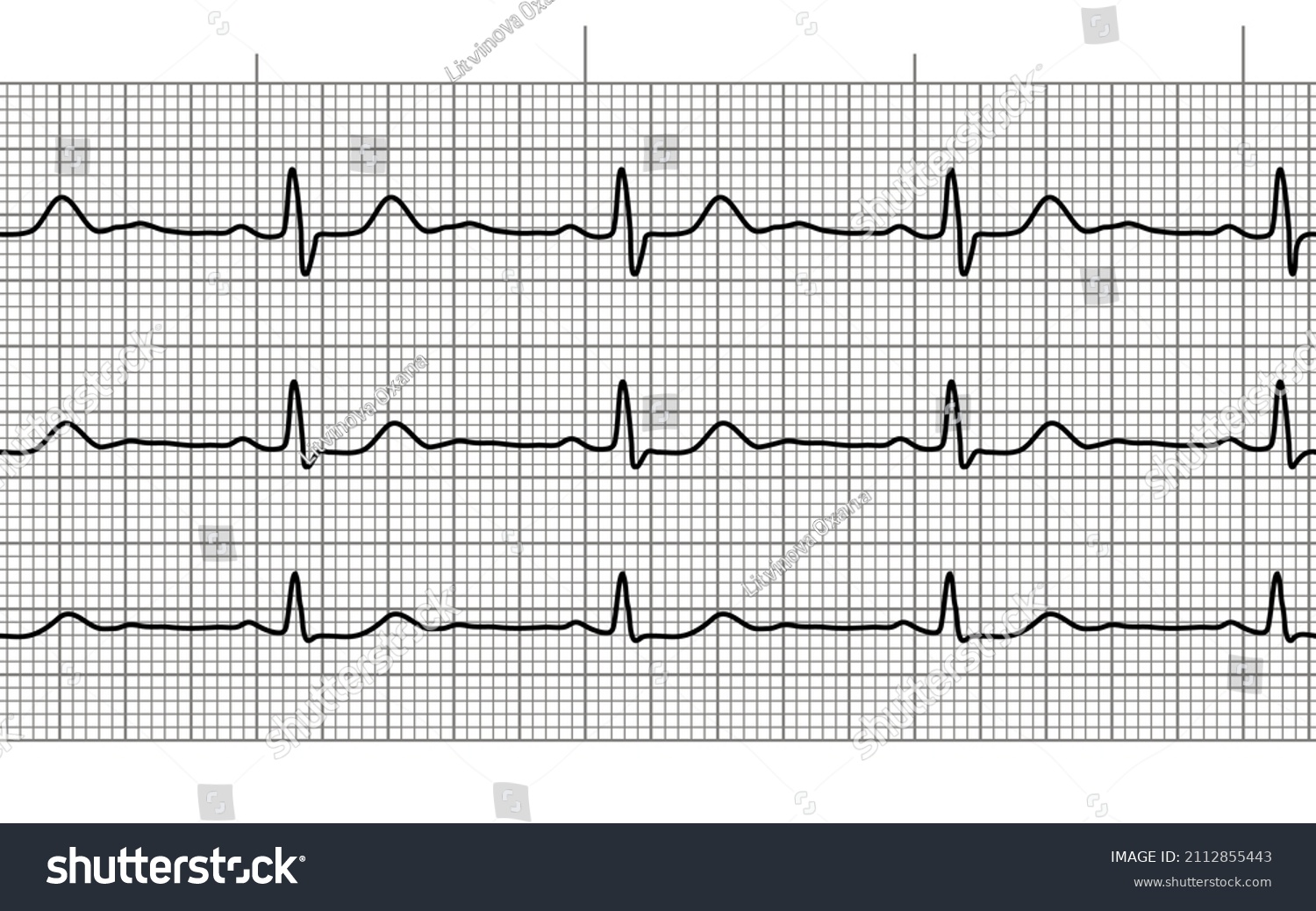 Heart Beat Ecg Ekg Seamless Line Stock Vector (Royalty Free) 2112855443 ...