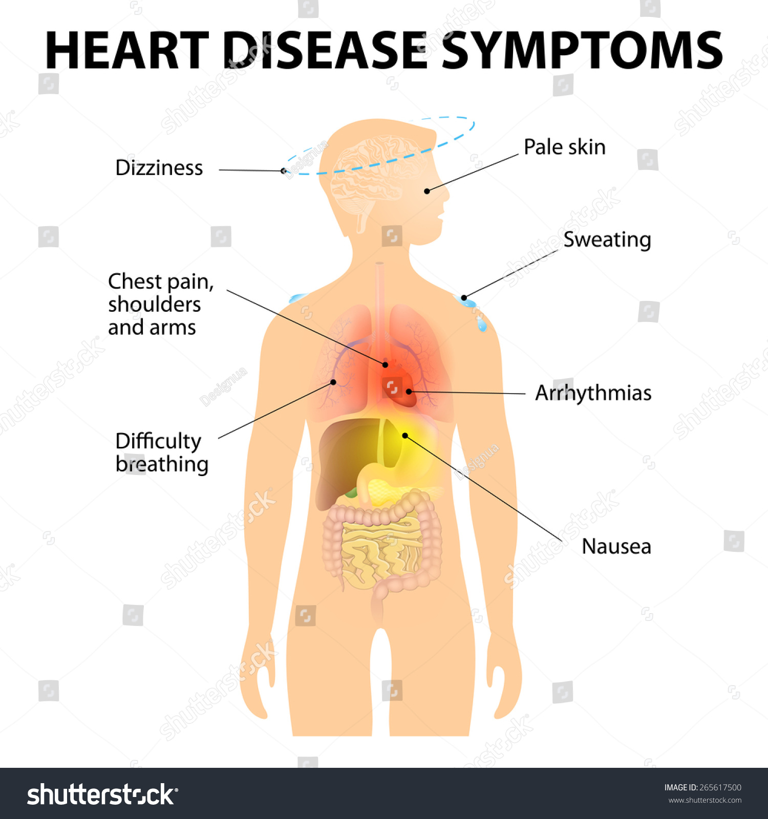 the symptoms of coronary heart disease the symptoms of coronary heart disease