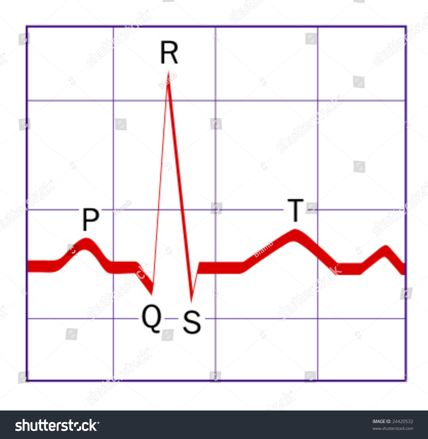 Heart Monitor Trace Stock Vector Illustration 24420532 : Shutterstock