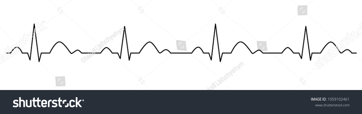 Heartbeat Line Cardiogram Electrocardiogram Vector Illustration Stock ...
