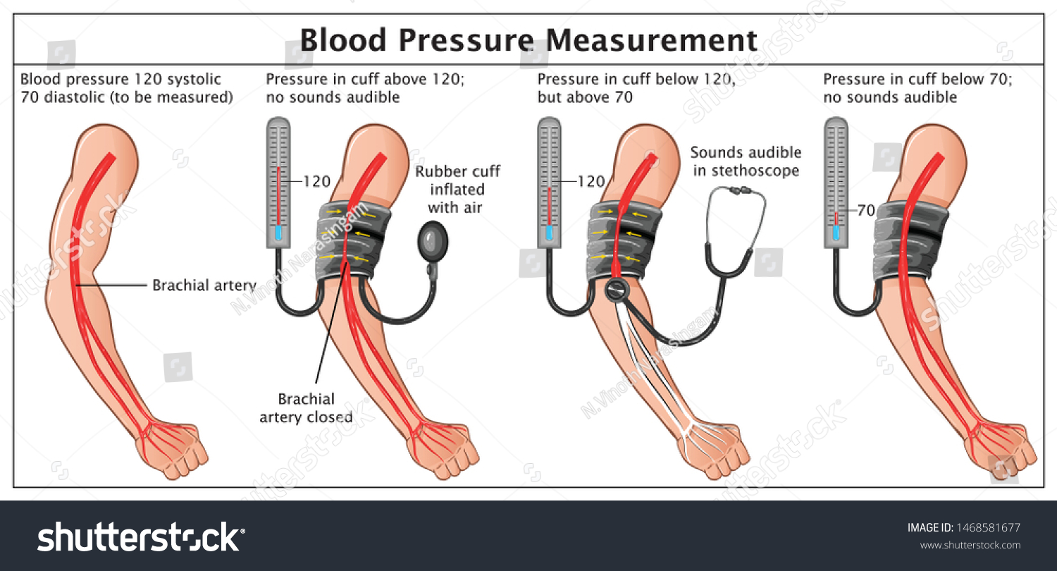 what is pressure measured in
