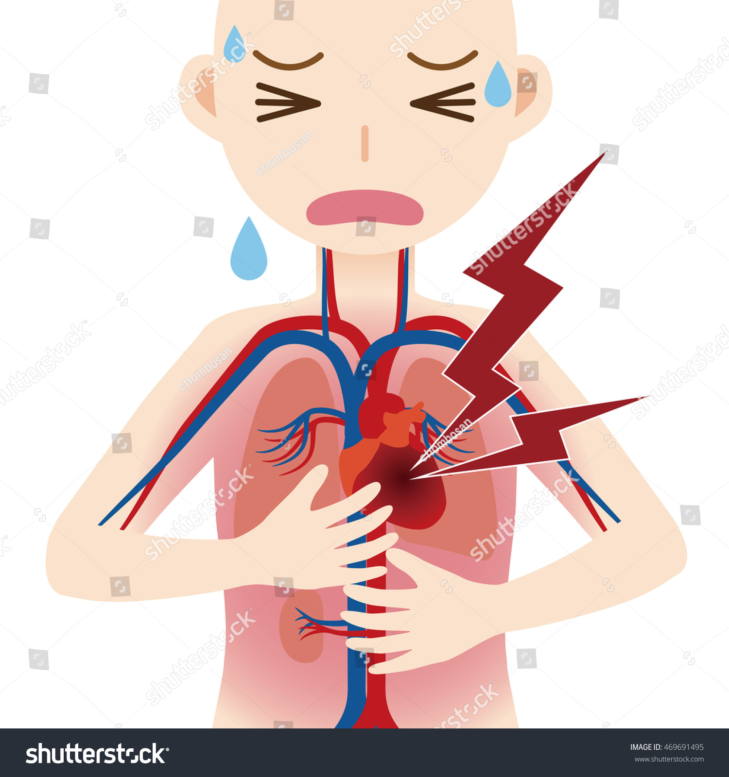 Human Circulatory System Heart Infarction Cardiac Stock Vector Royalty Free 469691495