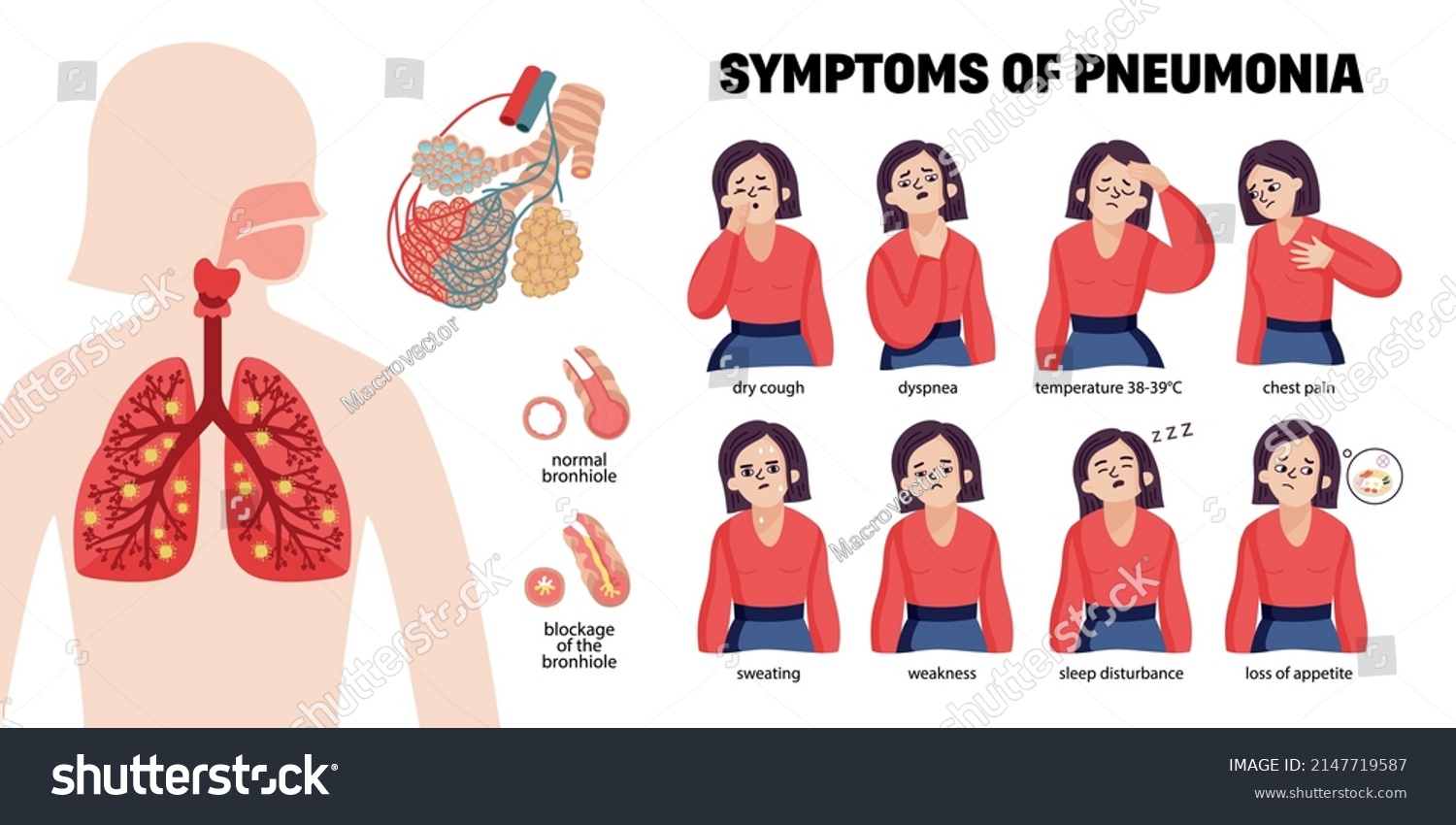 Human Pneumonia Infographics Female Characters Representing Stock Vector Royalty Free