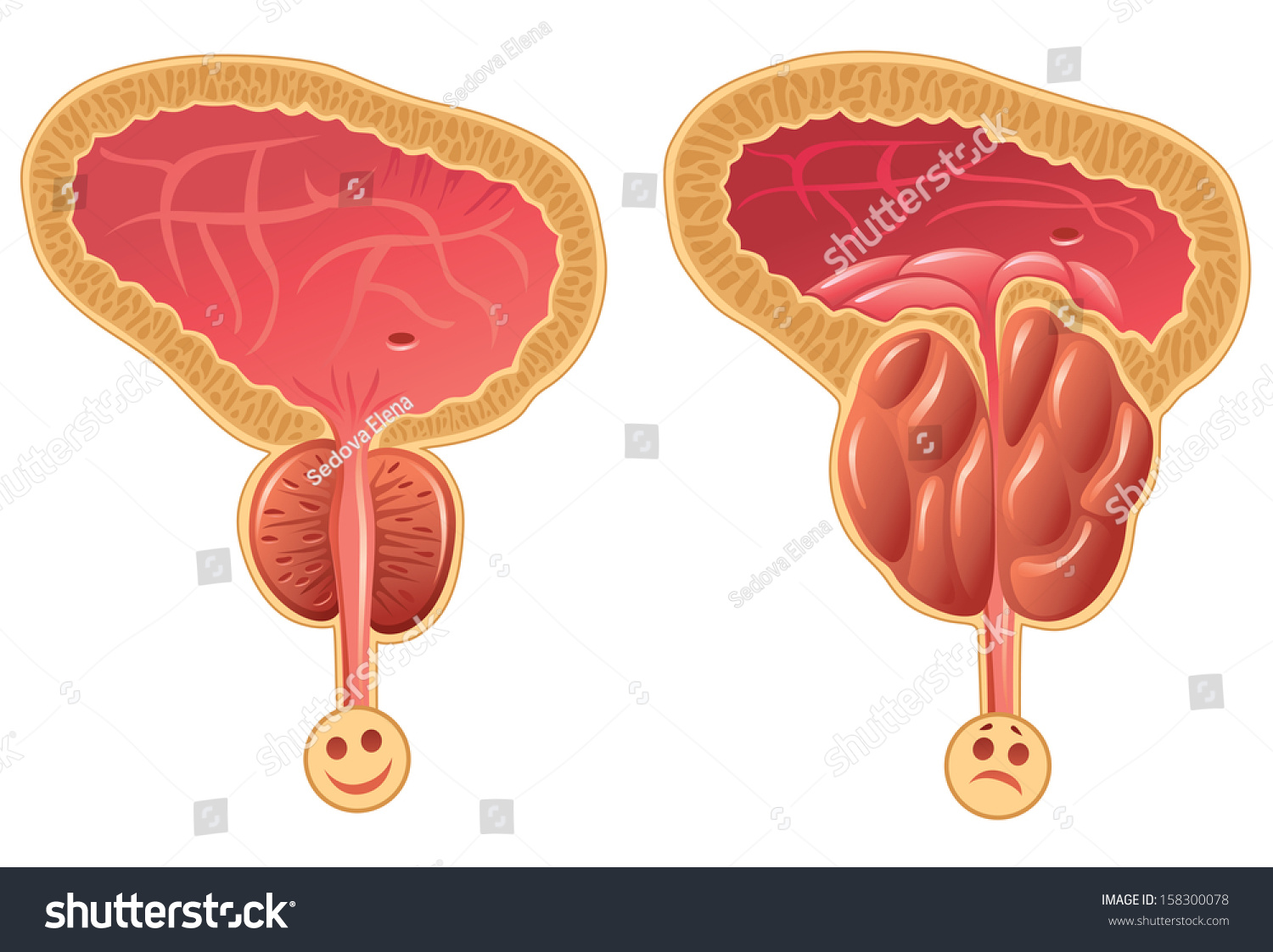 Human Prostate Gland Stock Vector Illustration Shutterstock