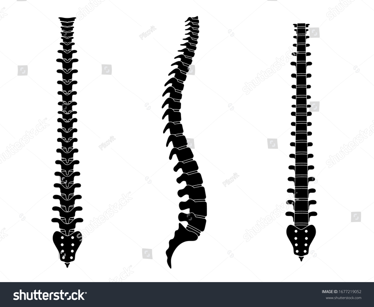 Human Spine Vector Illustration Backbone Vertebral Stock Vector ...