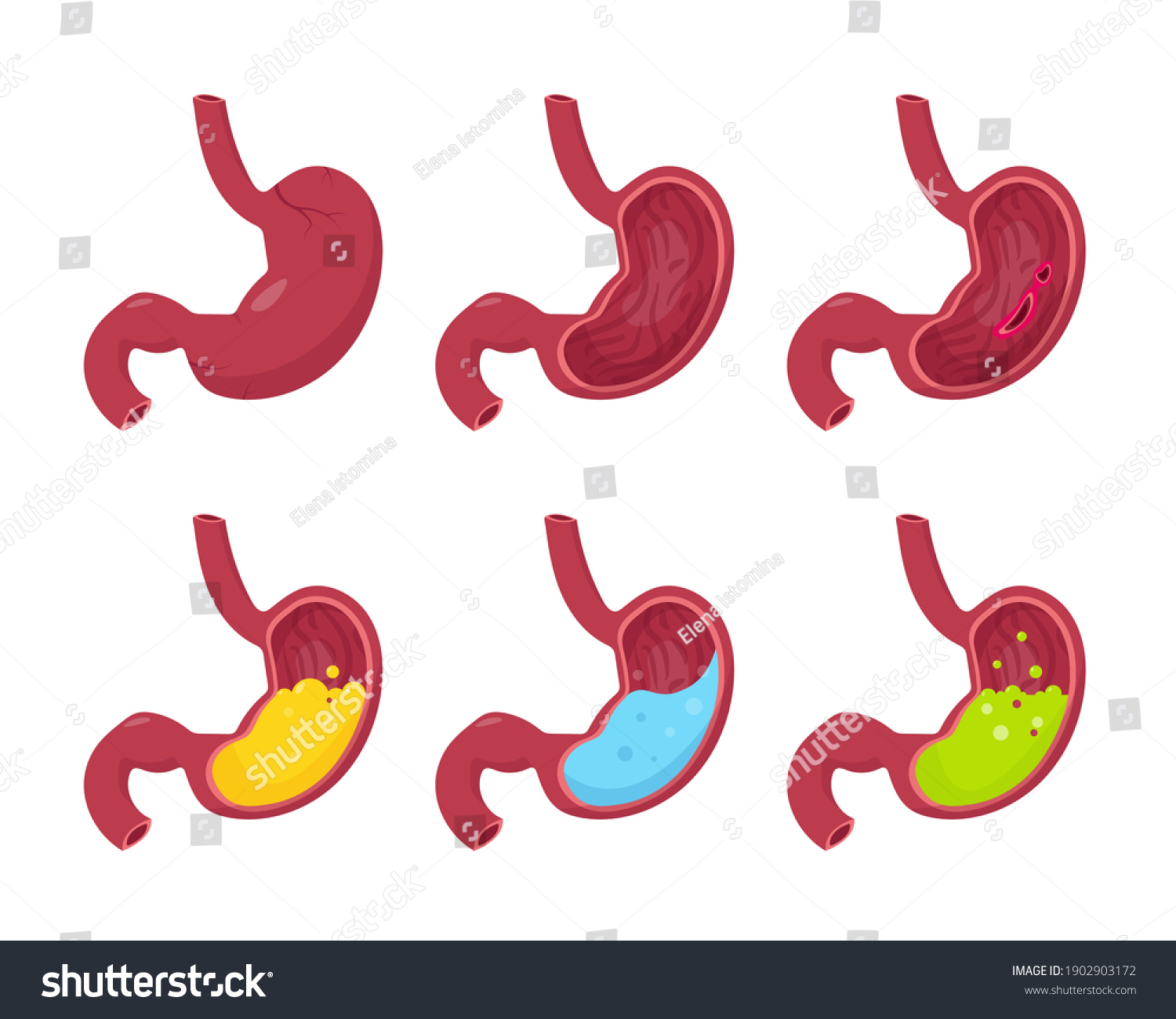 Human Stomaches Set Isolated On White Stock Vector (Royalty Free ...