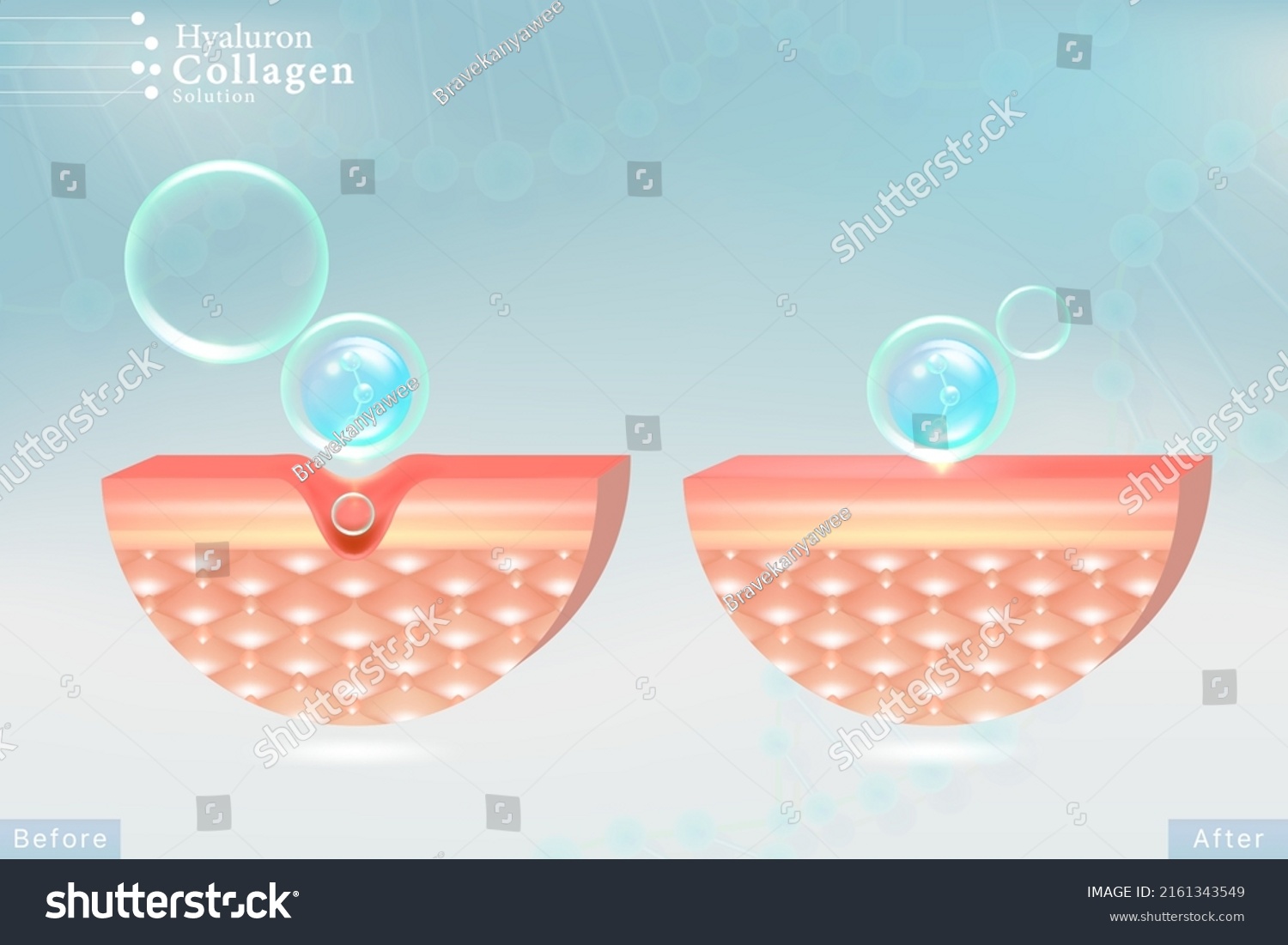 Hyaluronic Acid Before After Hair Skin Stock Vector (Royalty Free ...