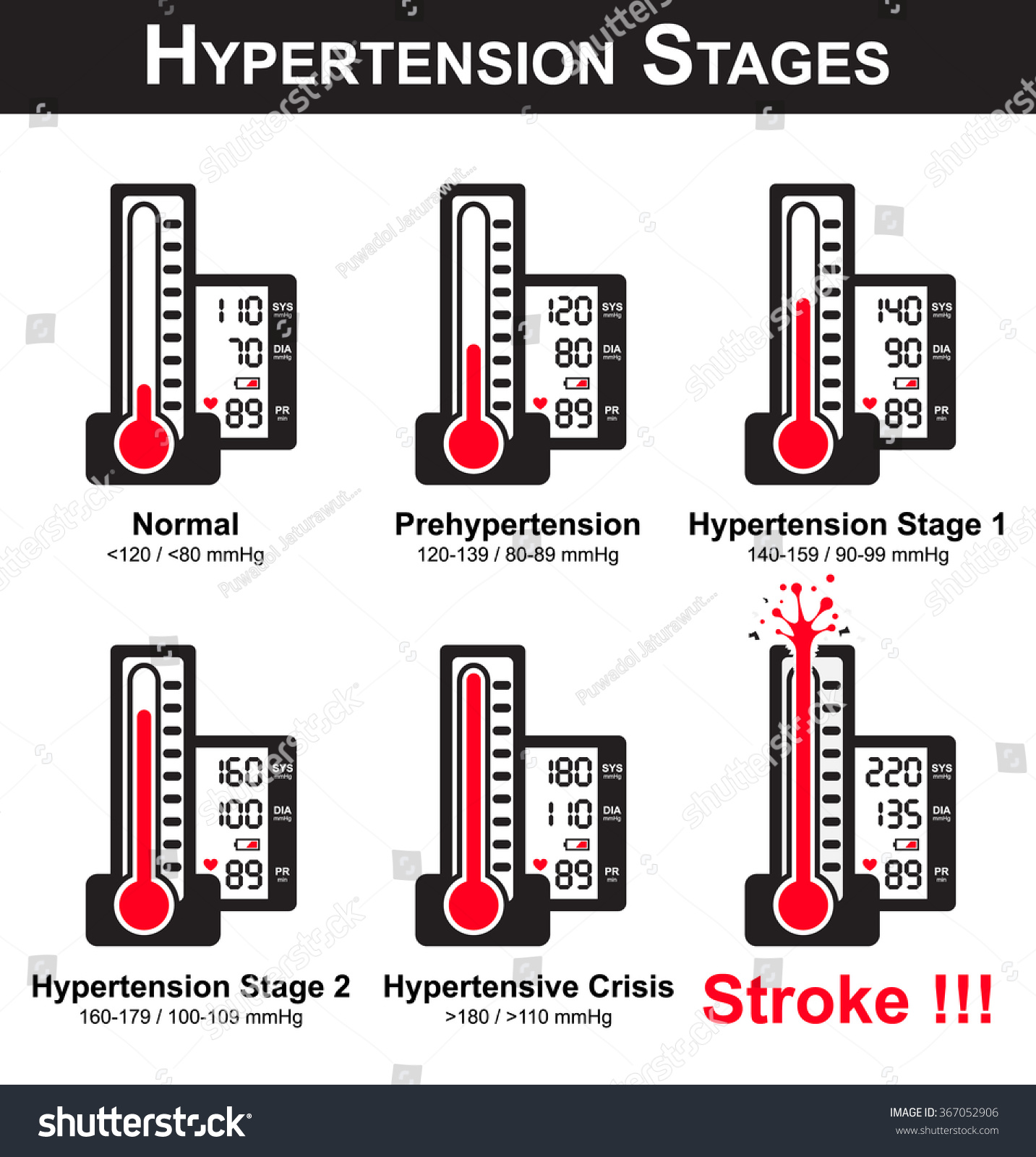 stages of high blood pressure