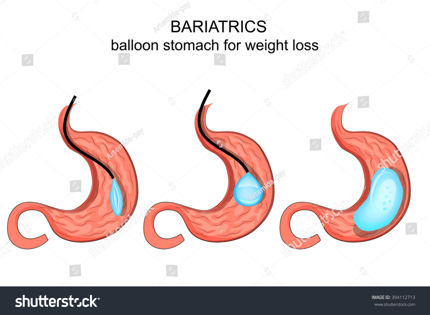Does Drinking Cold Water Help To Lose Weight Does drinking cold water help to lose weight