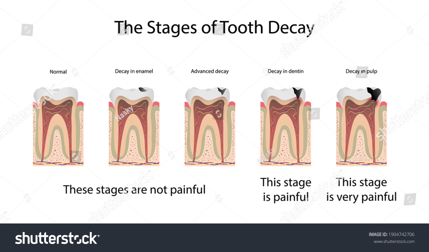 Decay Stock Vectors, Images & Vector Art 