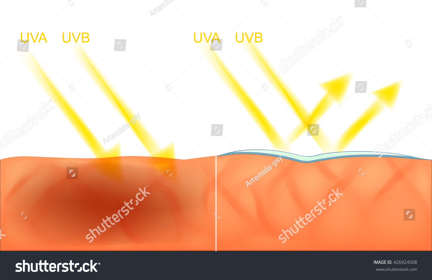 Illustration Skin Damage Sun Protection Uv Stock Vector 426924508 ...