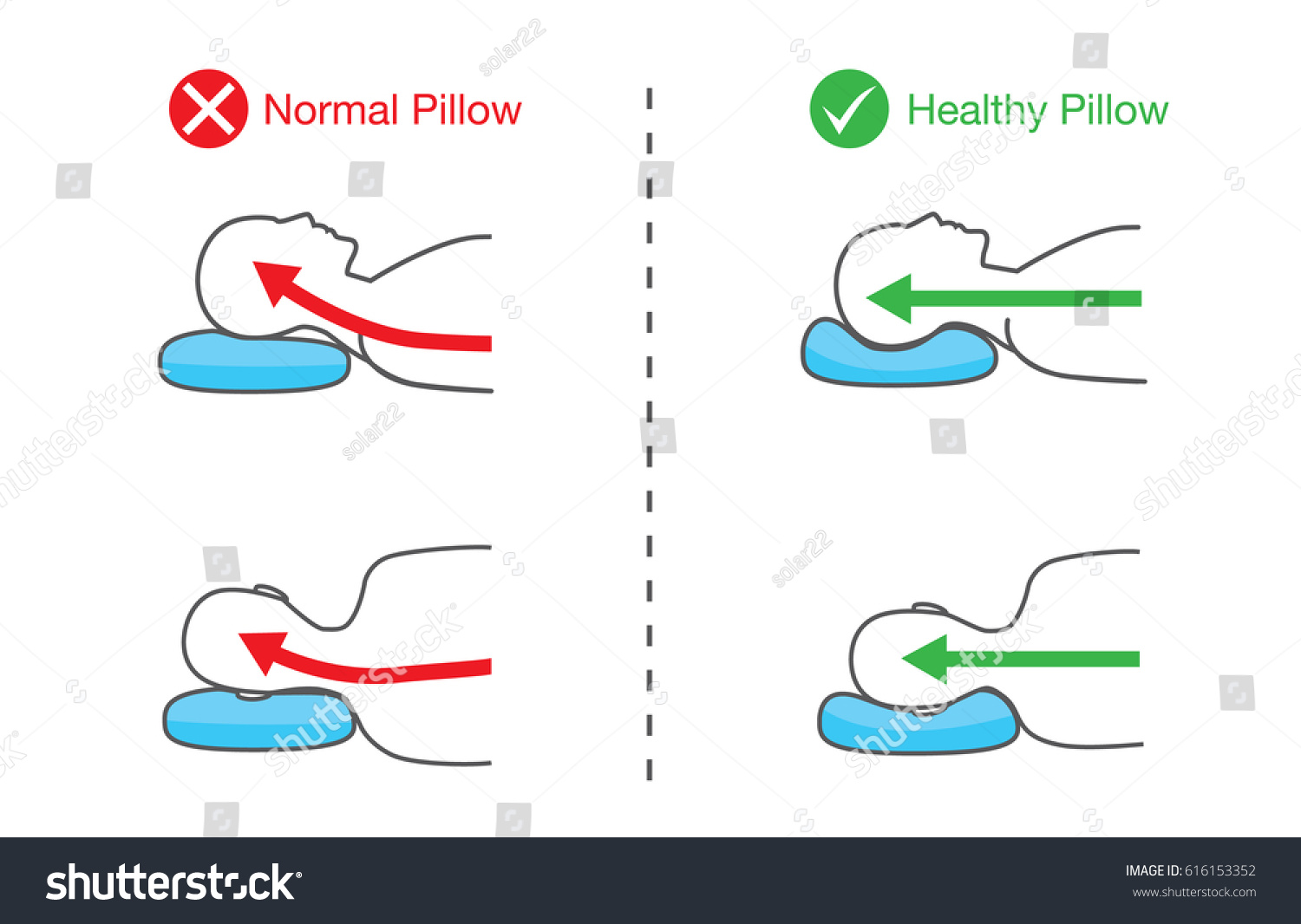 SVG of Illustration of spine line of people when sleep on normal pillow and healthy pillow.
 svg