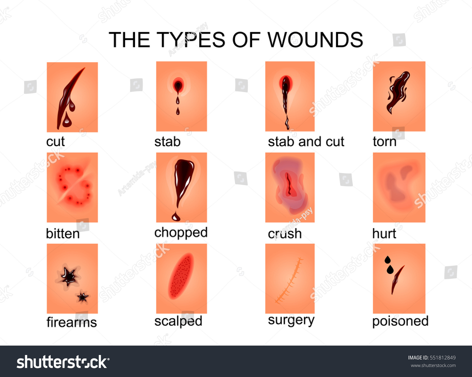 594-types-of-wounds-vector-images-stock-photos-vectors-shutterstock