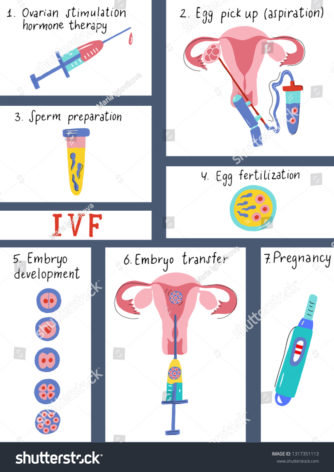 Vitro Fertilization Infographic Flat Handdrawn Style Stock Vector Royalty Free 1317351113 4693