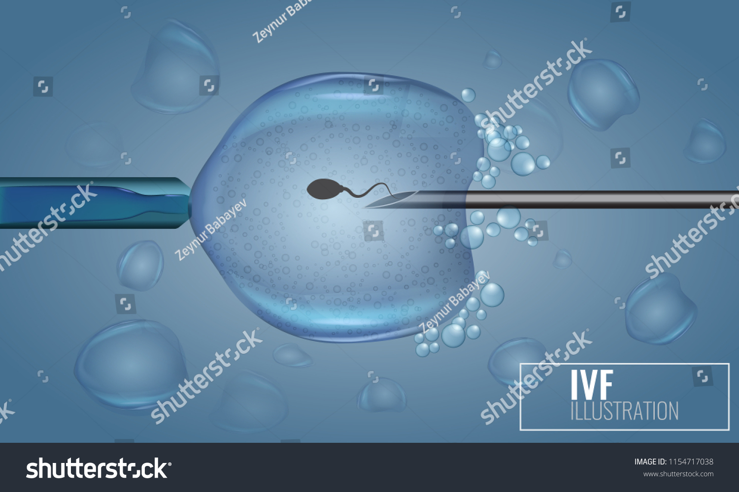 Vitro Fertilization Injection Artificial Insemination Scientific Stock Vector Royalty Free 