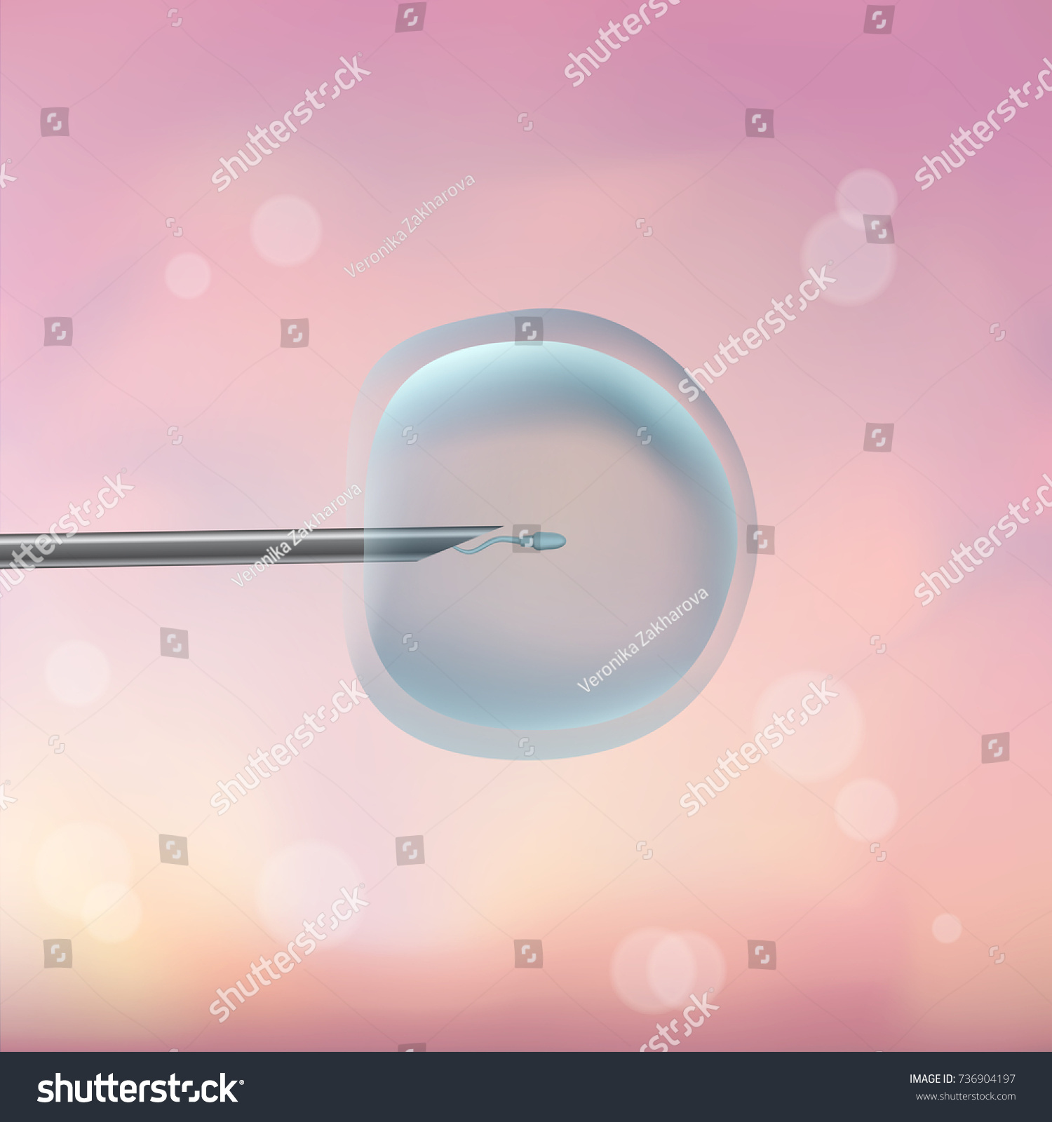 Vitro Fertilization Ivf Artificial Insemination Icsi Stock Vector Vitro Fertilization Ivf Artificial Insemination Icsi Stock Vector