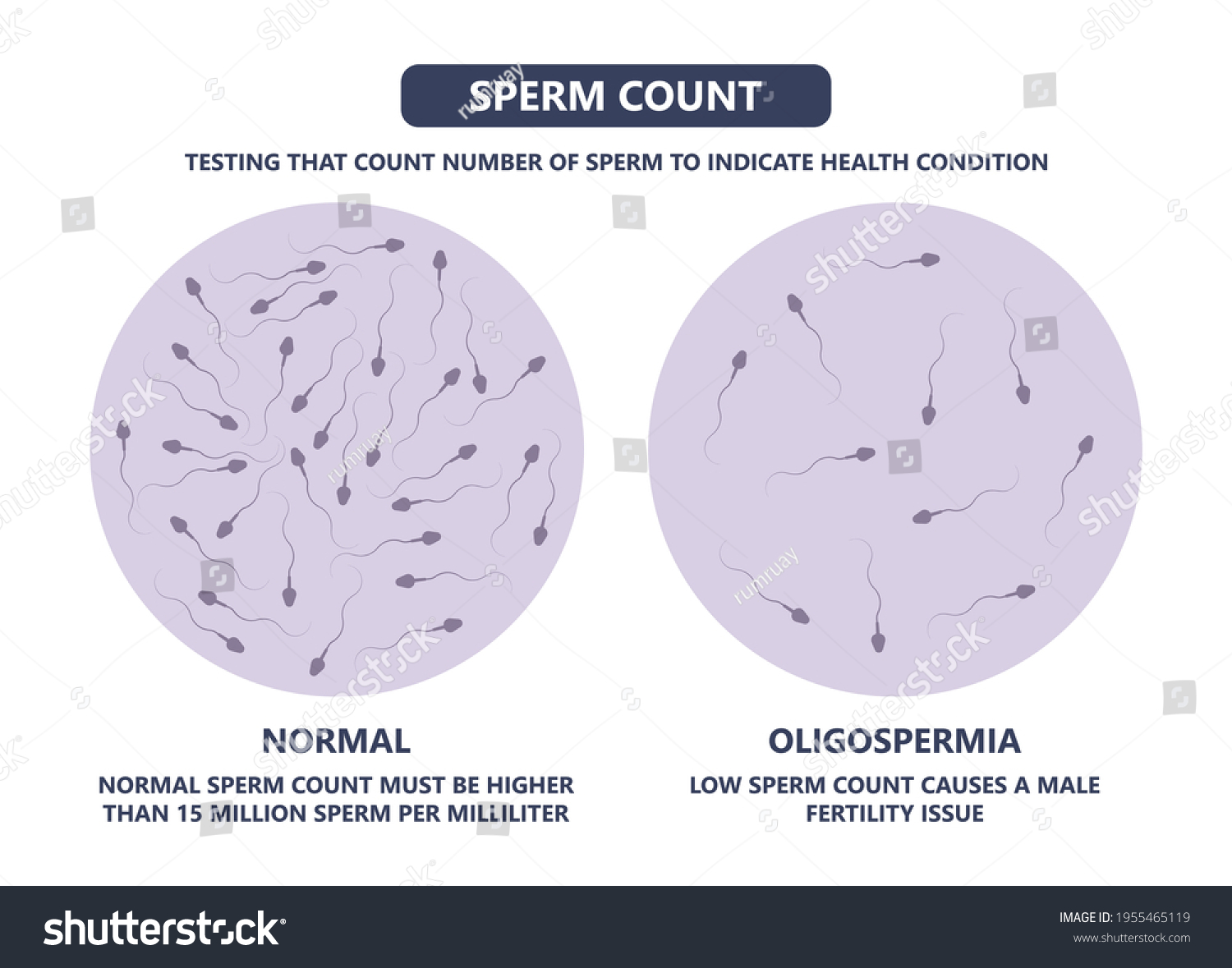 Vitro Fertilization Ivf Semen Test Sample Stock Vector Royalty Free 1955465119 Shutterstock 