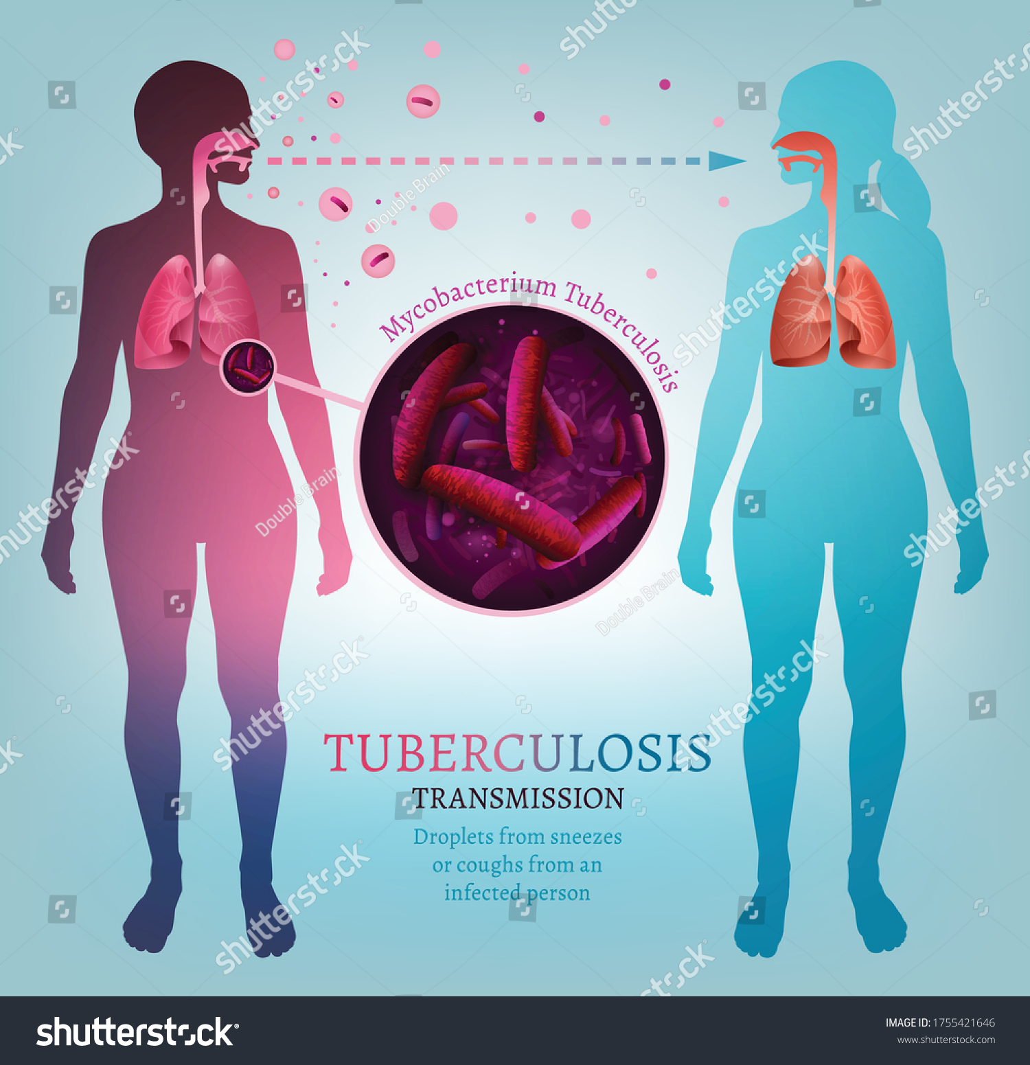 Tuberculosis. Images, Stock Photos & Vectors | Shutterstock