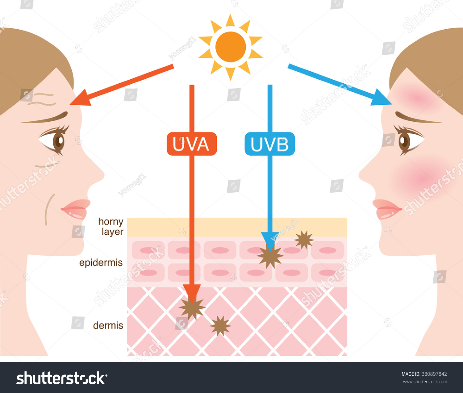 Infographic Skin Illustration Difference Between Uva Stock Vector ...