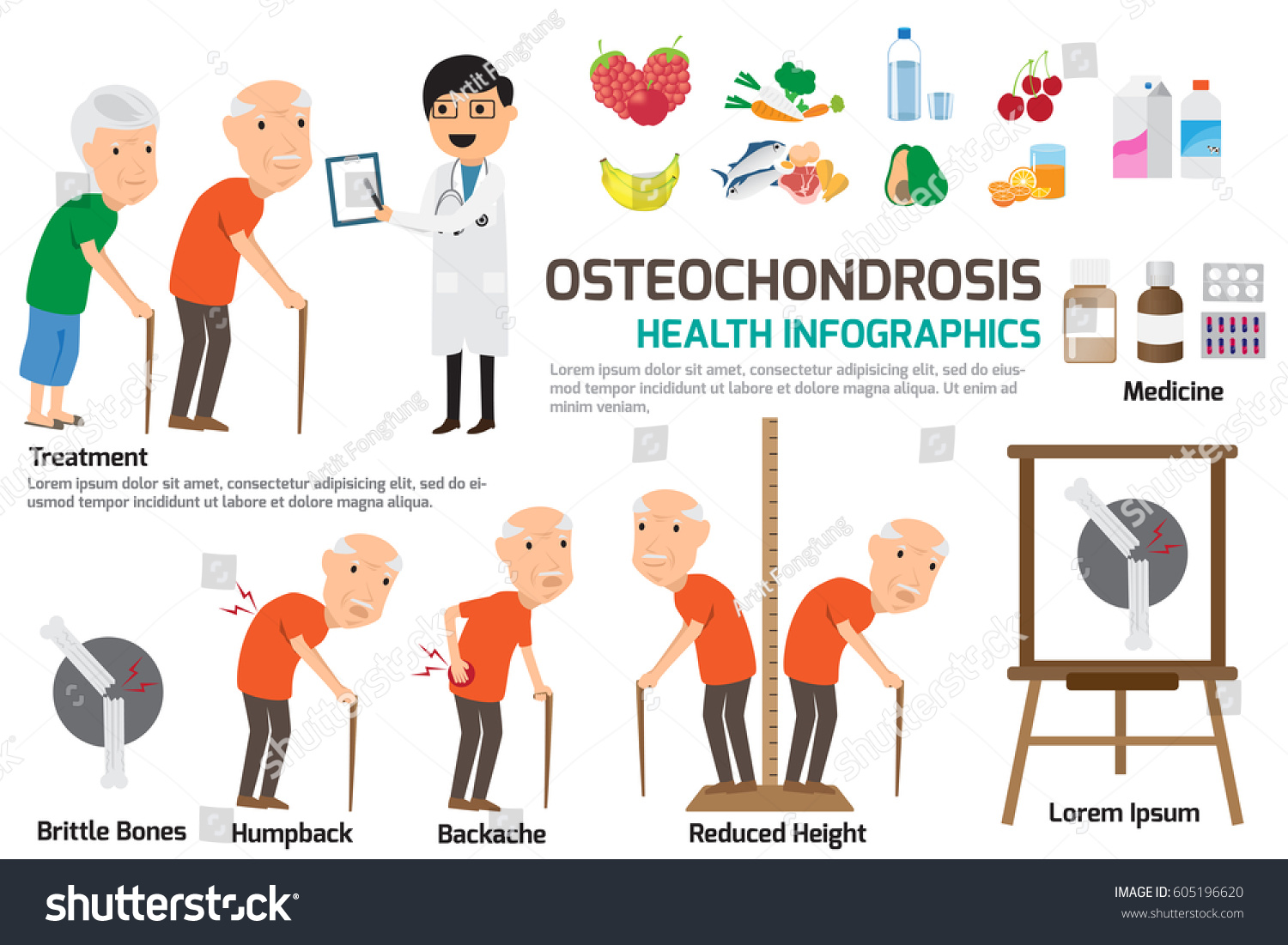 Symptoms and treatment of cervical osteochondrosis in women 7 Symptoms and treatment of cervical osteochondrosis in women 100