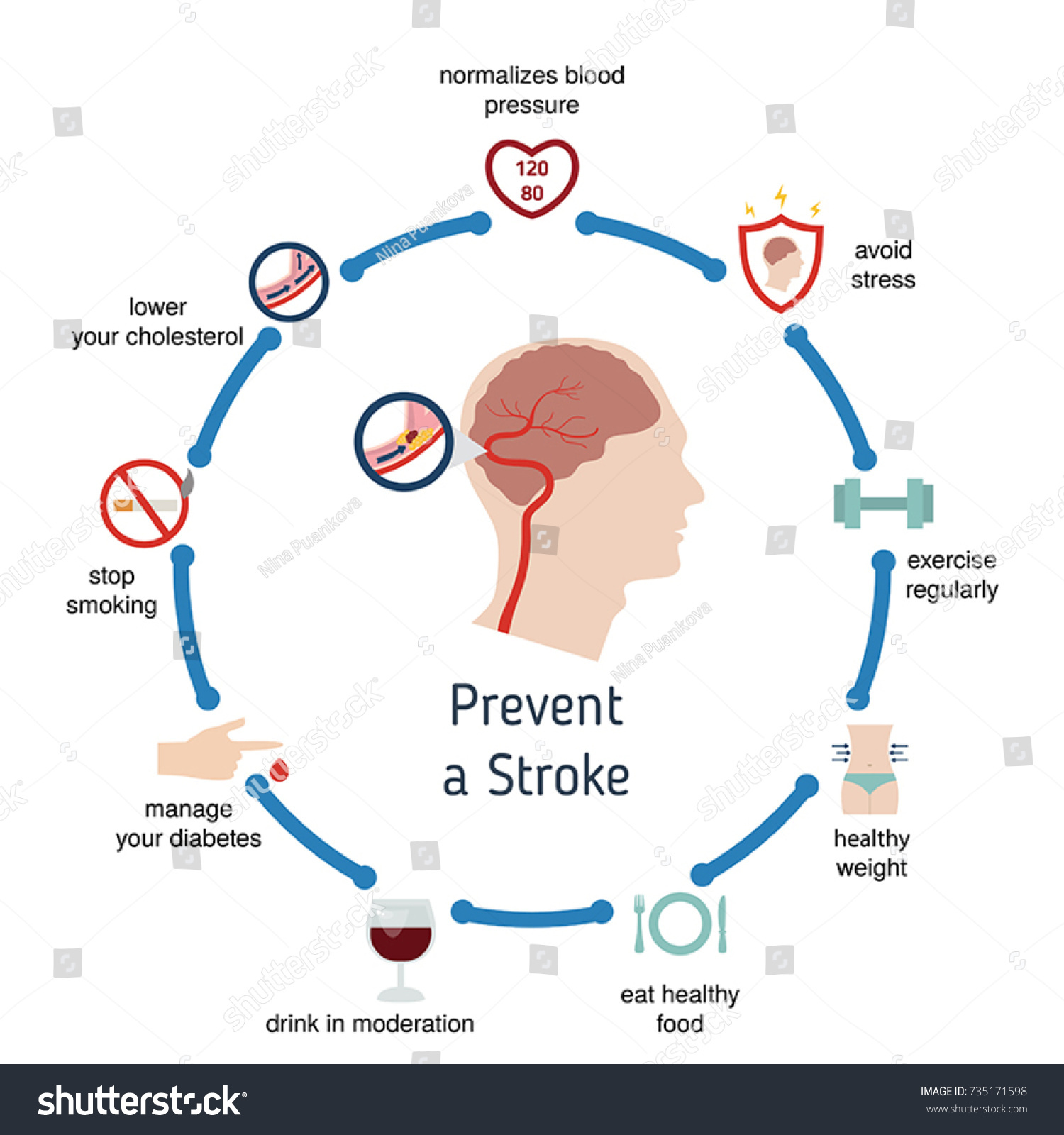 Infographics Stroke Stroke Risk Factors Vector Hot Sex Picture 4911