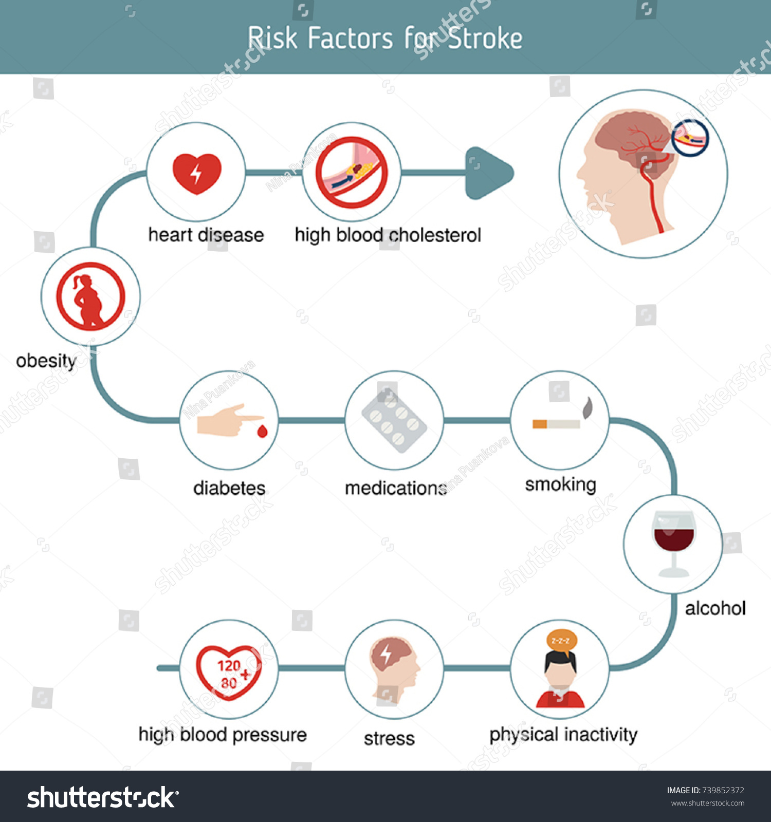 Infographics Stroke Stroke Risk Factors Vector เวกเตอร์สต็อก ปลอดค่าลิขสิทธิ์ 739852372 9150