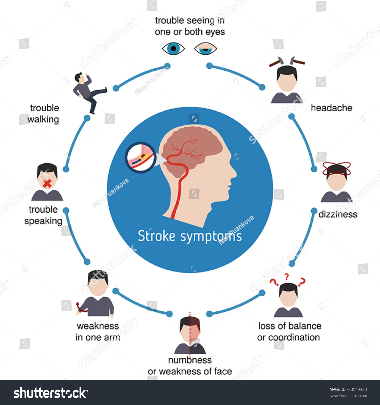 Infographics Stroke Stroke Symptoms Vector Illustration: Vector Có Sẵn ...