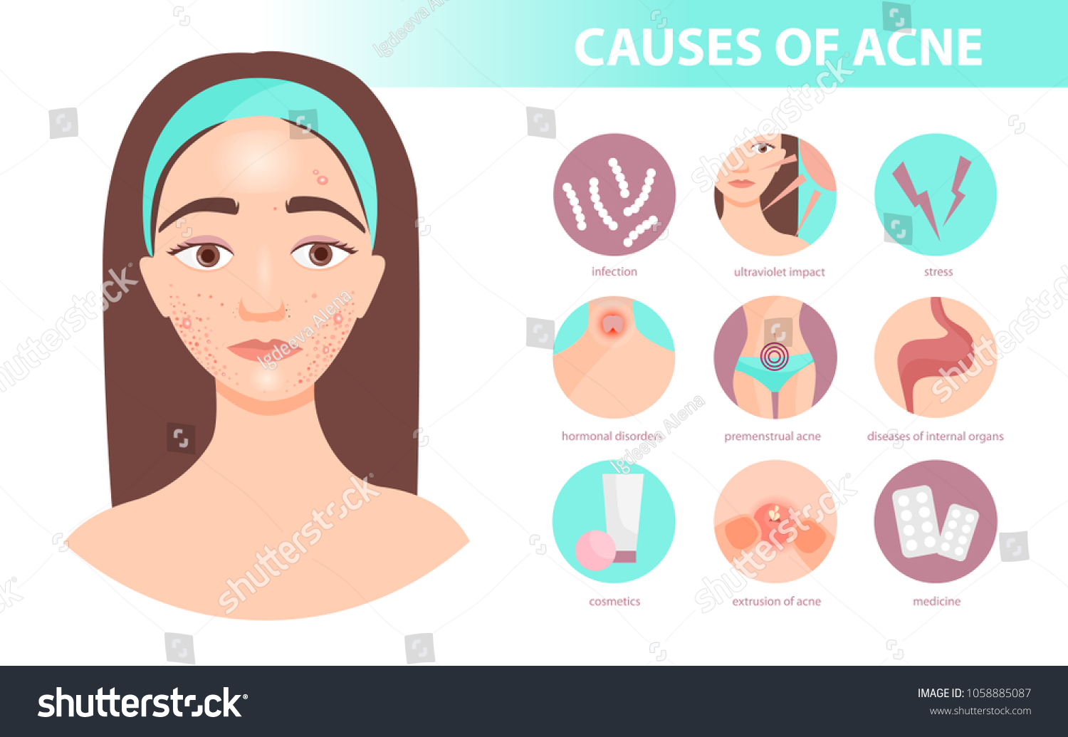 Acne Types Causes And Treatment Infographics Vector Image Hot Sex Picture