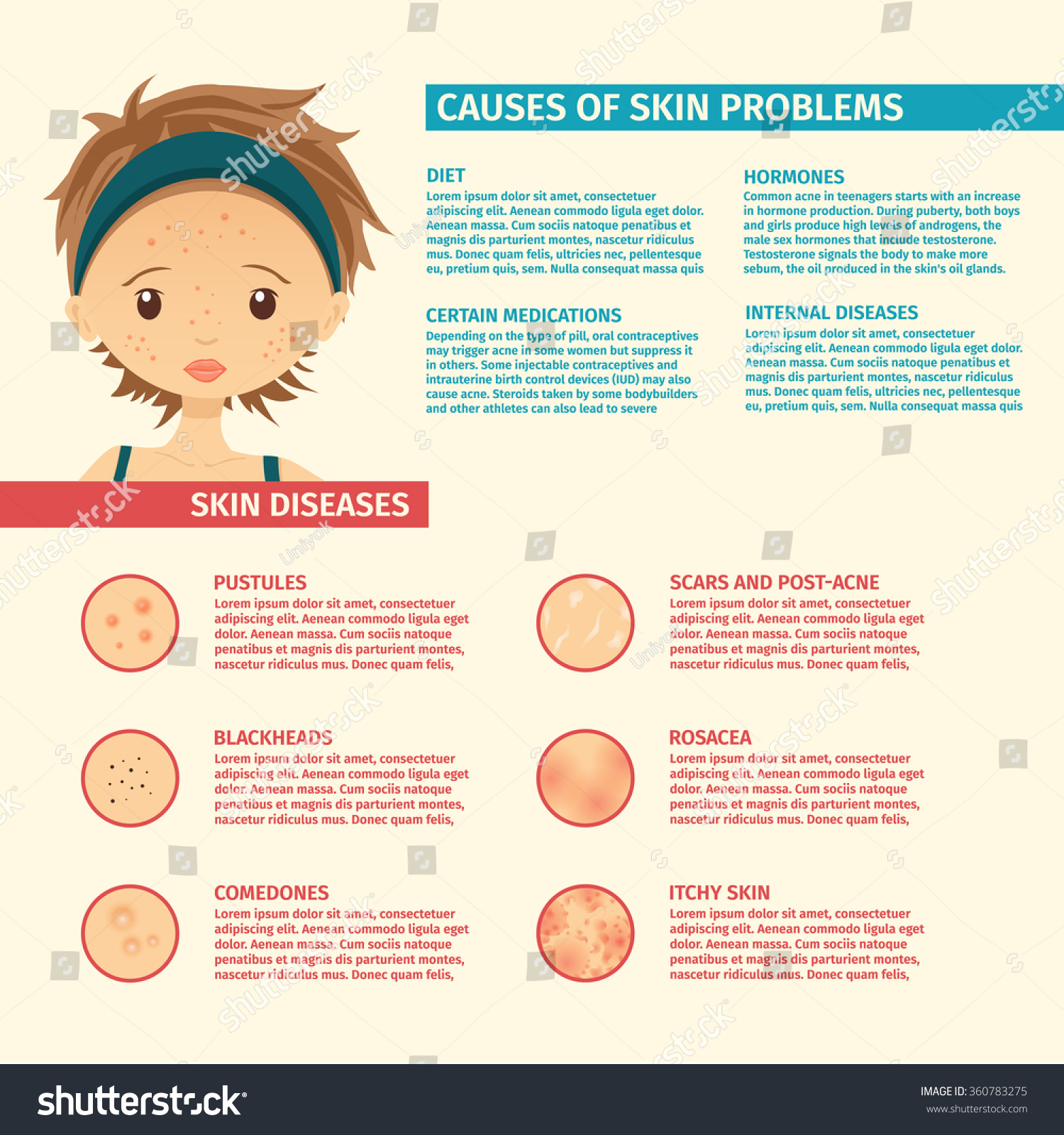 infographics skin problems causes problem skin のベクター画像素材