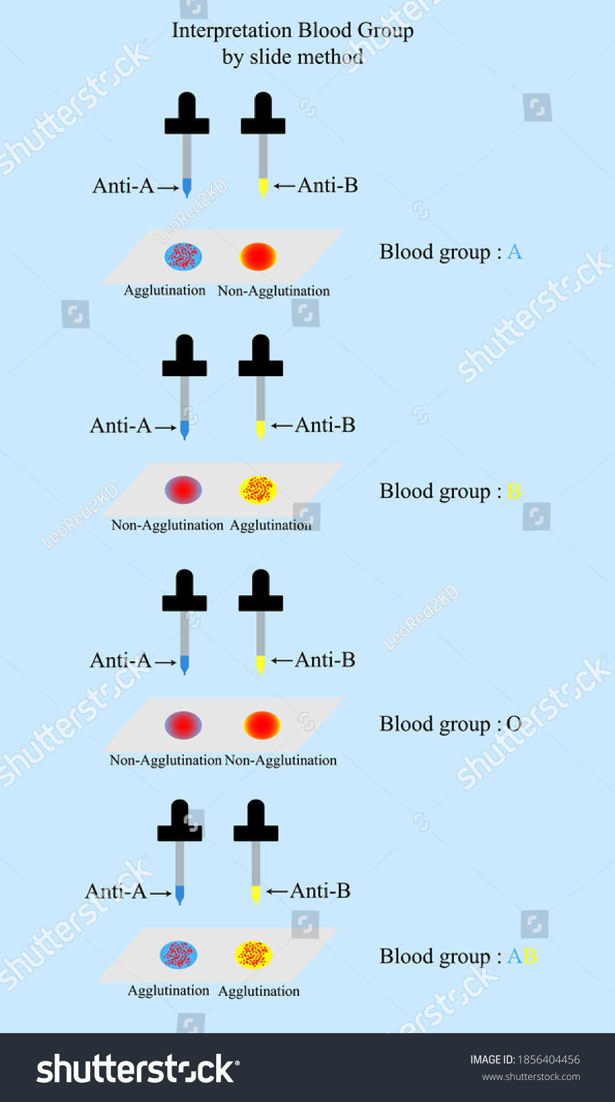 248 Blood Group Slide Images Stock Photos Vectors Shutterstock