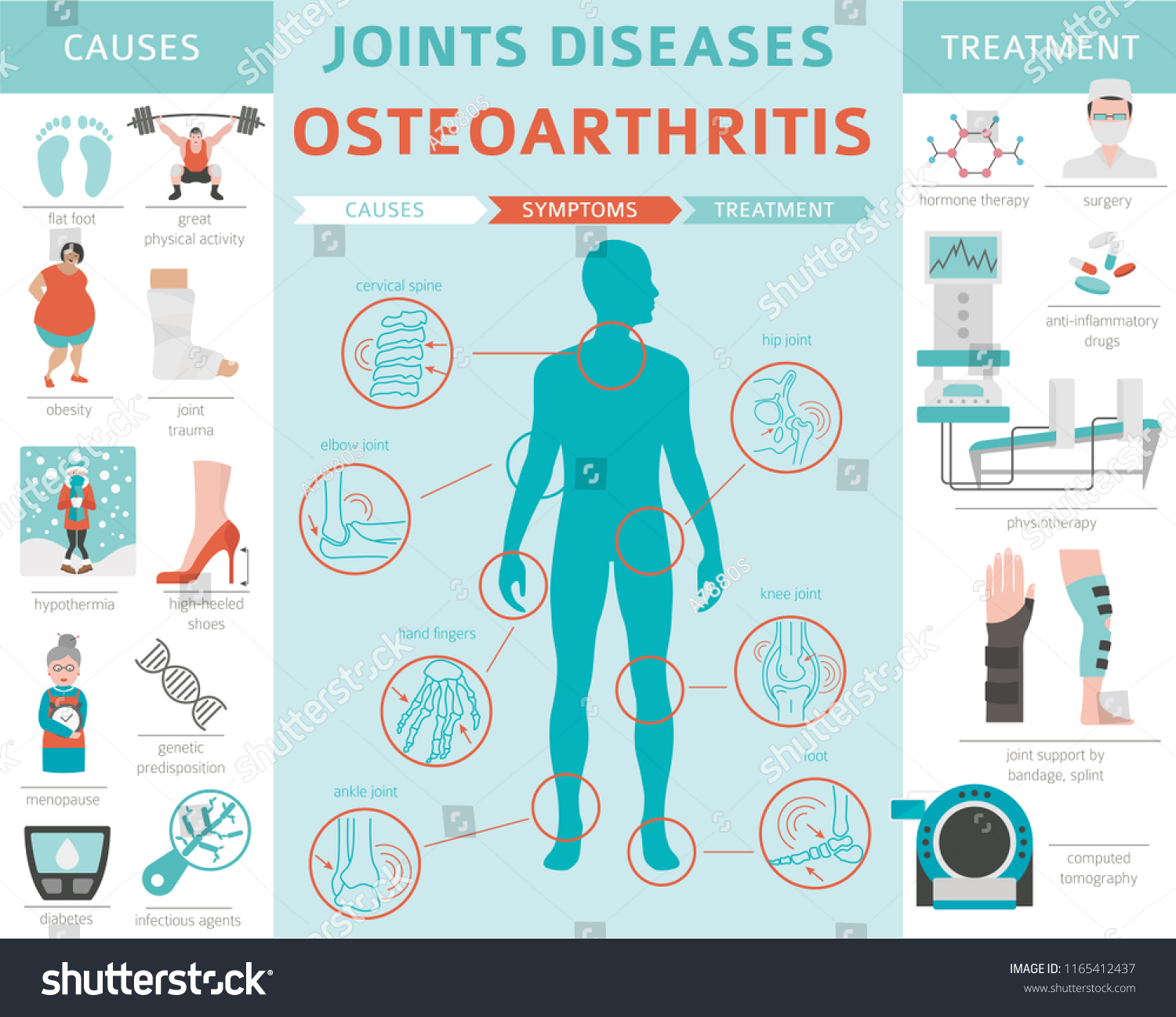 Joints Diseases Arthritis Osteoarthritis Symptoms Treatment Stock ...