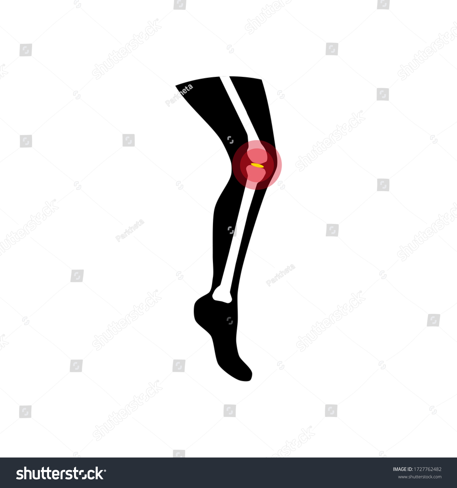 Leg Joints Pain Illustration On White Stock Vector (Royalty Free ...