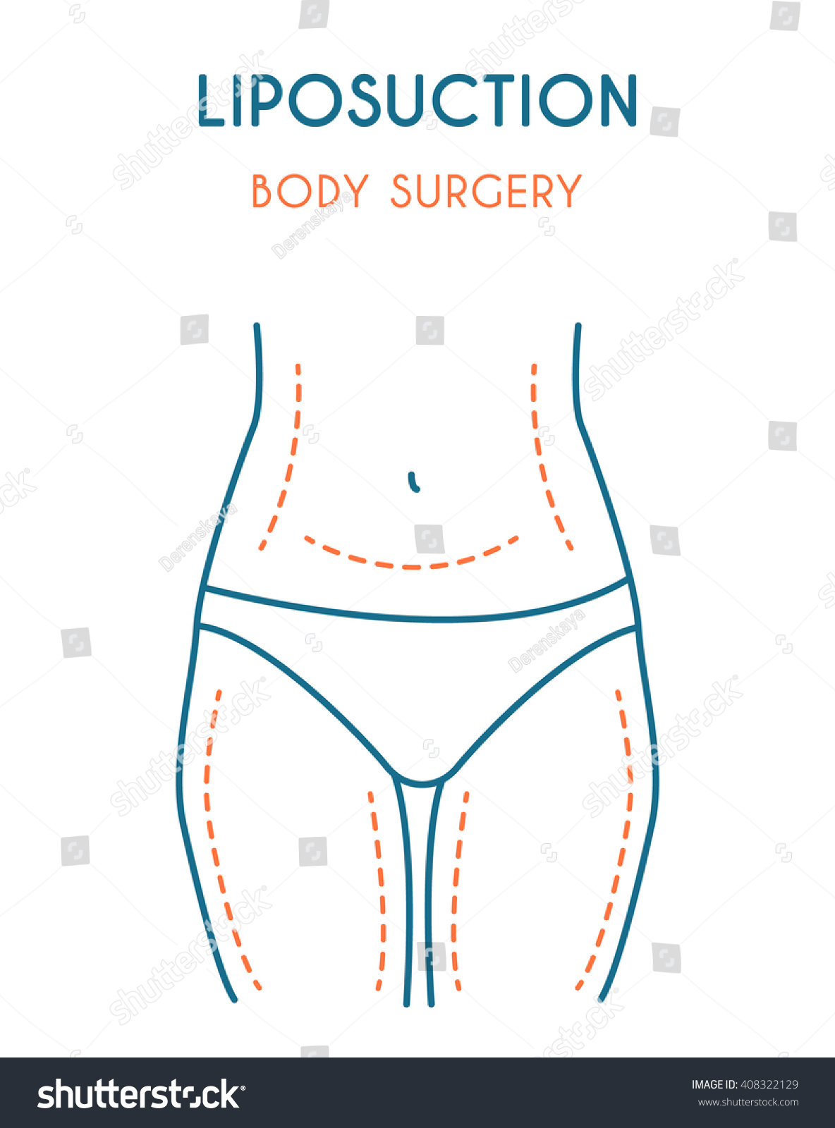 SVG of Liposuction poster. Modern vector illustration. svg