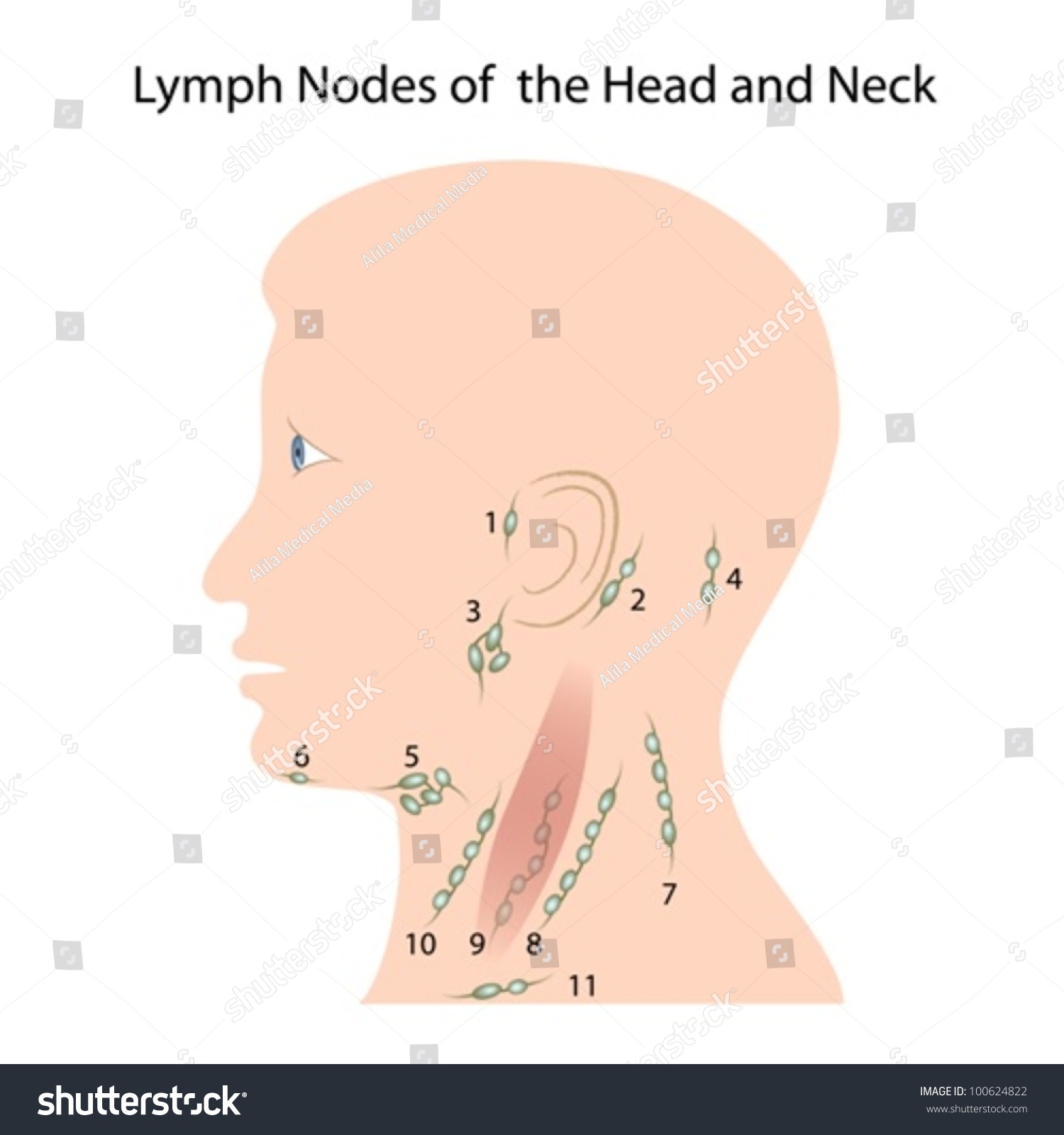 Lymph Nodes Head Neck Stock Vector 100624822 - Shutterstock