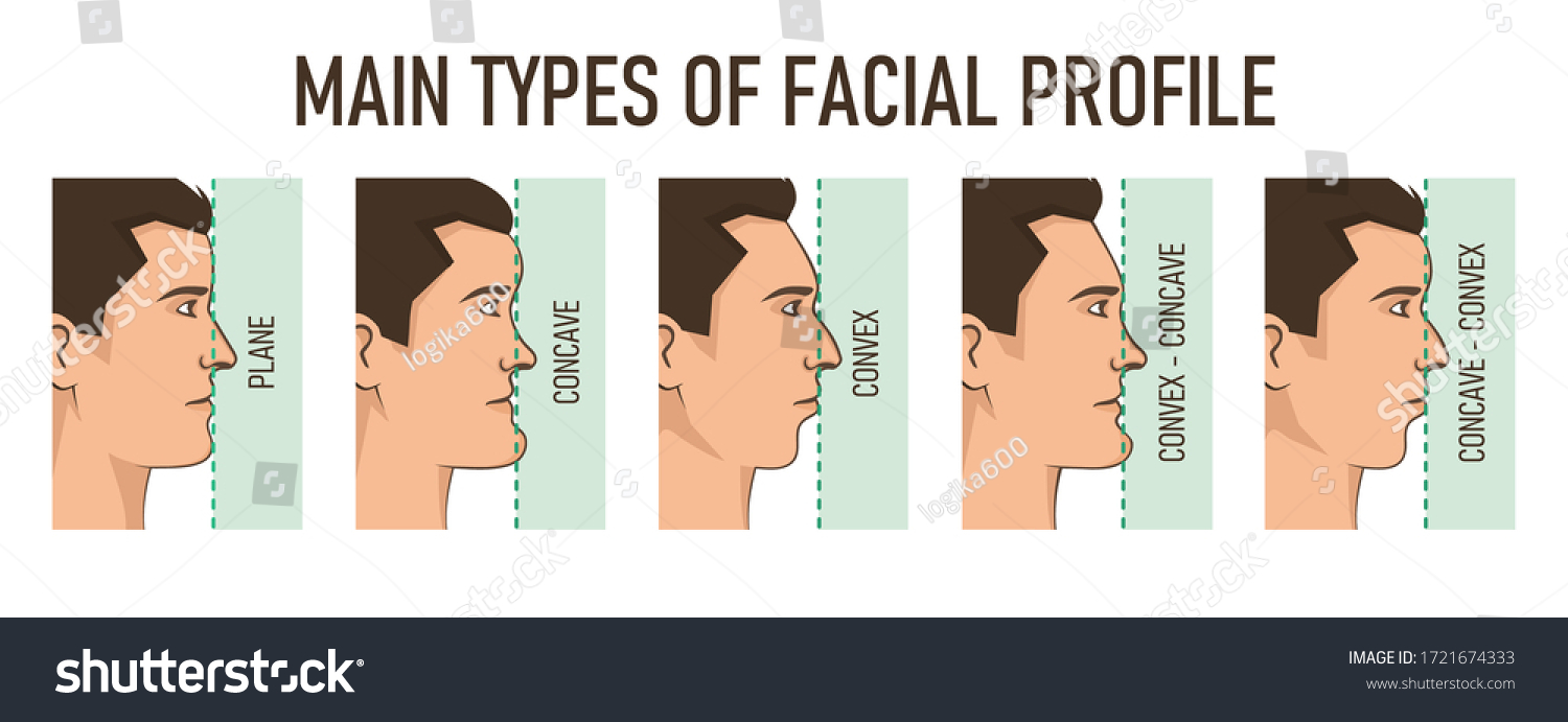 main-types-facial-profile-convex-concave