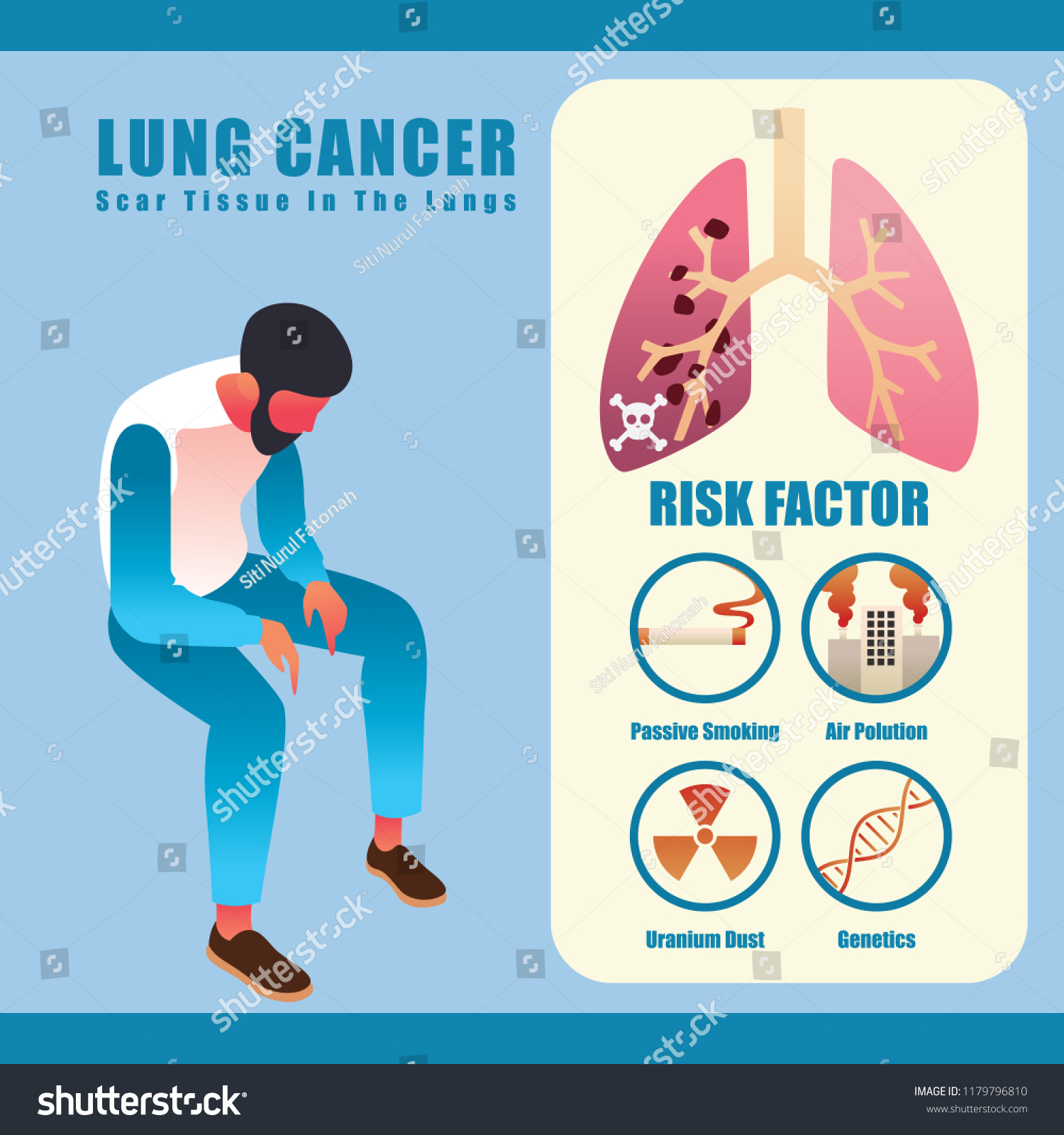 Non Small Cell Lung Cancer Causes And Risk Factors