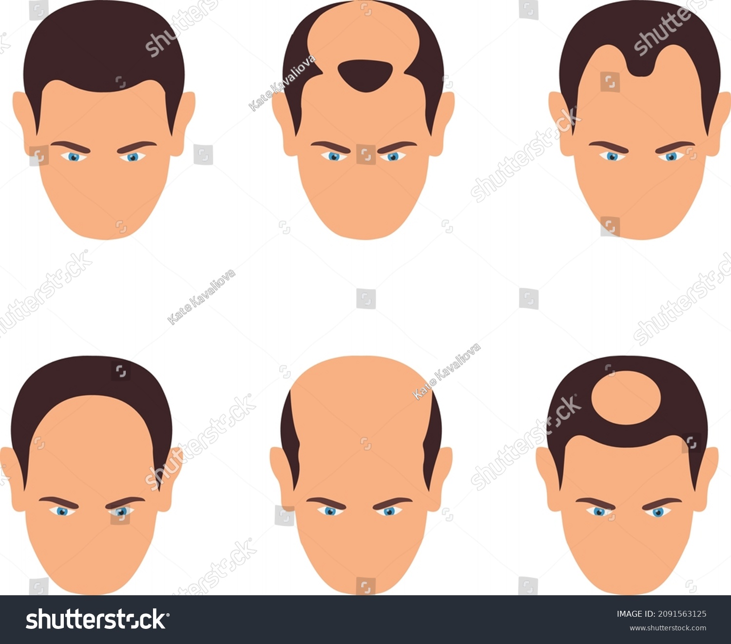 Bald head cartoon Images, Stock Photos & Vectors | Shutterstock