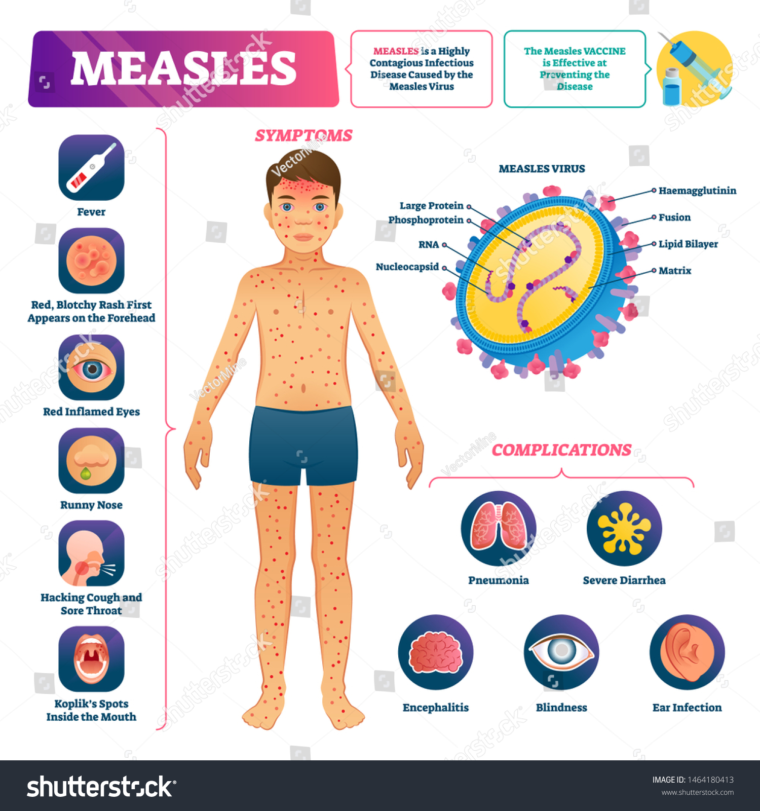 Measles Vector Illustration Labeled Medical Virus Stock Vector (Royalty ...