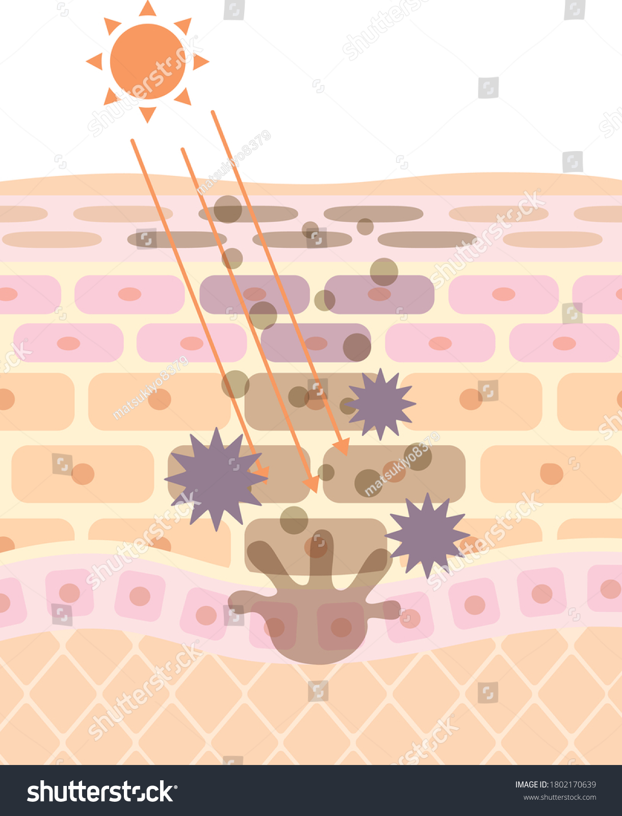 Mechanism Explanation Illustration Sunburn Stock Vector (Royalty Free ...