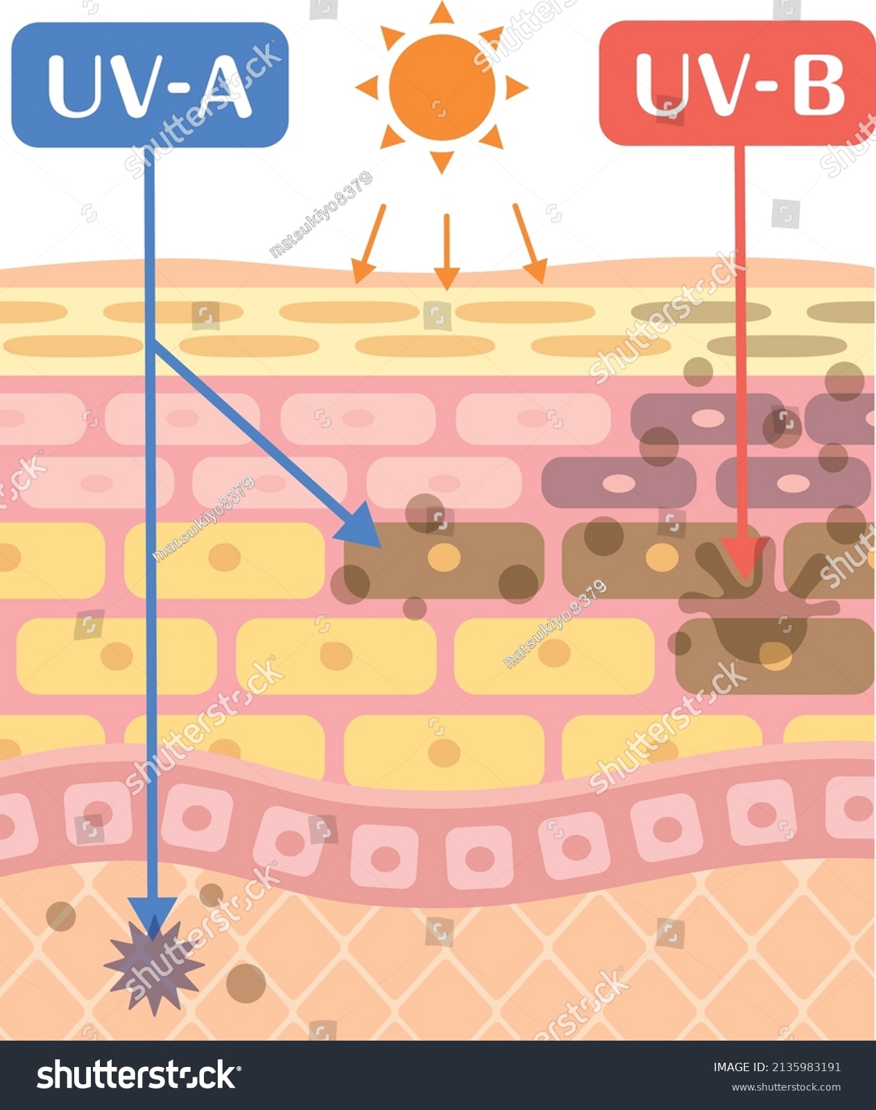 Mechanism Explanation Illustration Sunburn Stock Vector (royalty Free 