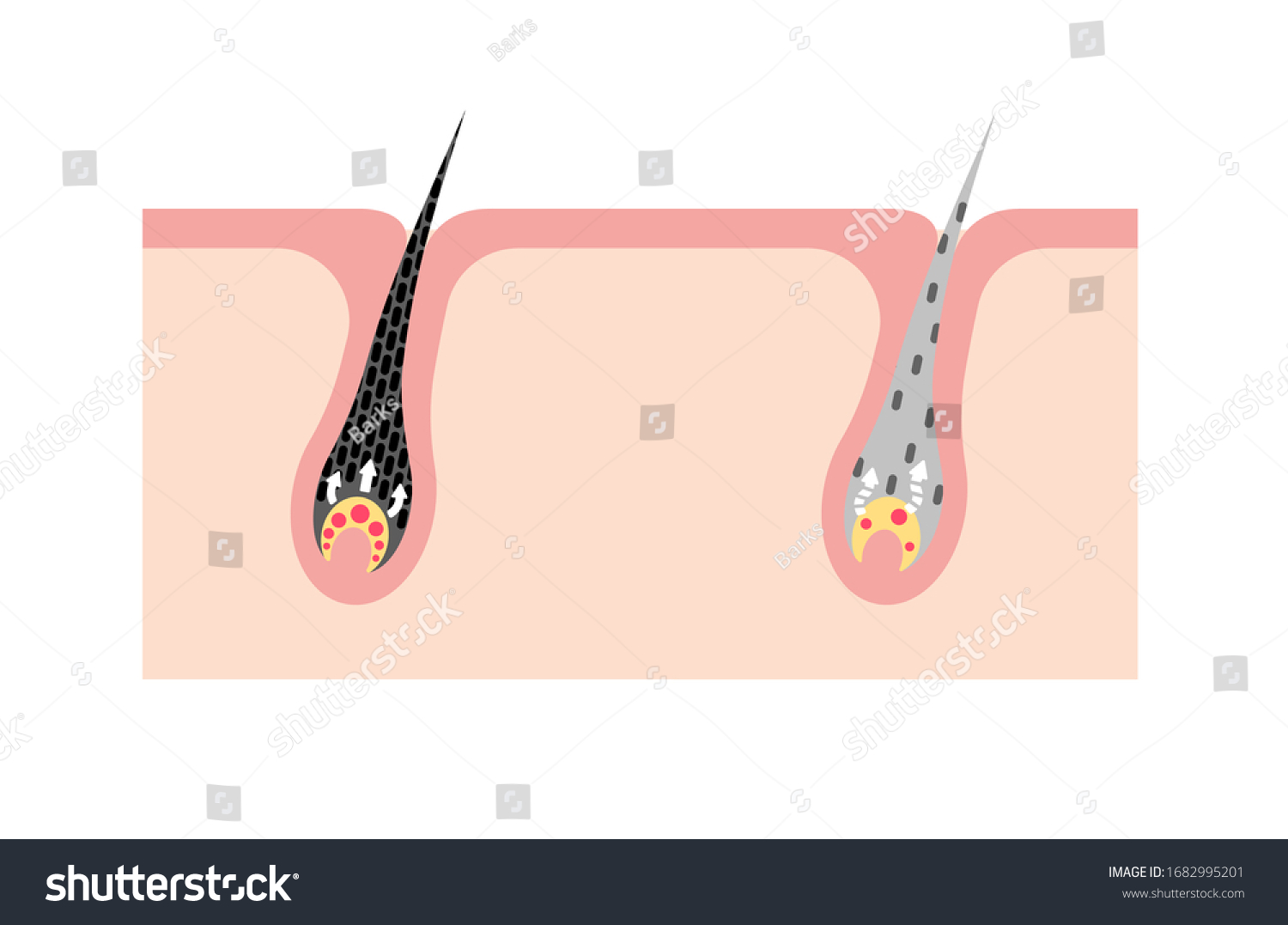 416 Scalp pigmentation Images, Stock Photos & Vectors | Shutterstock