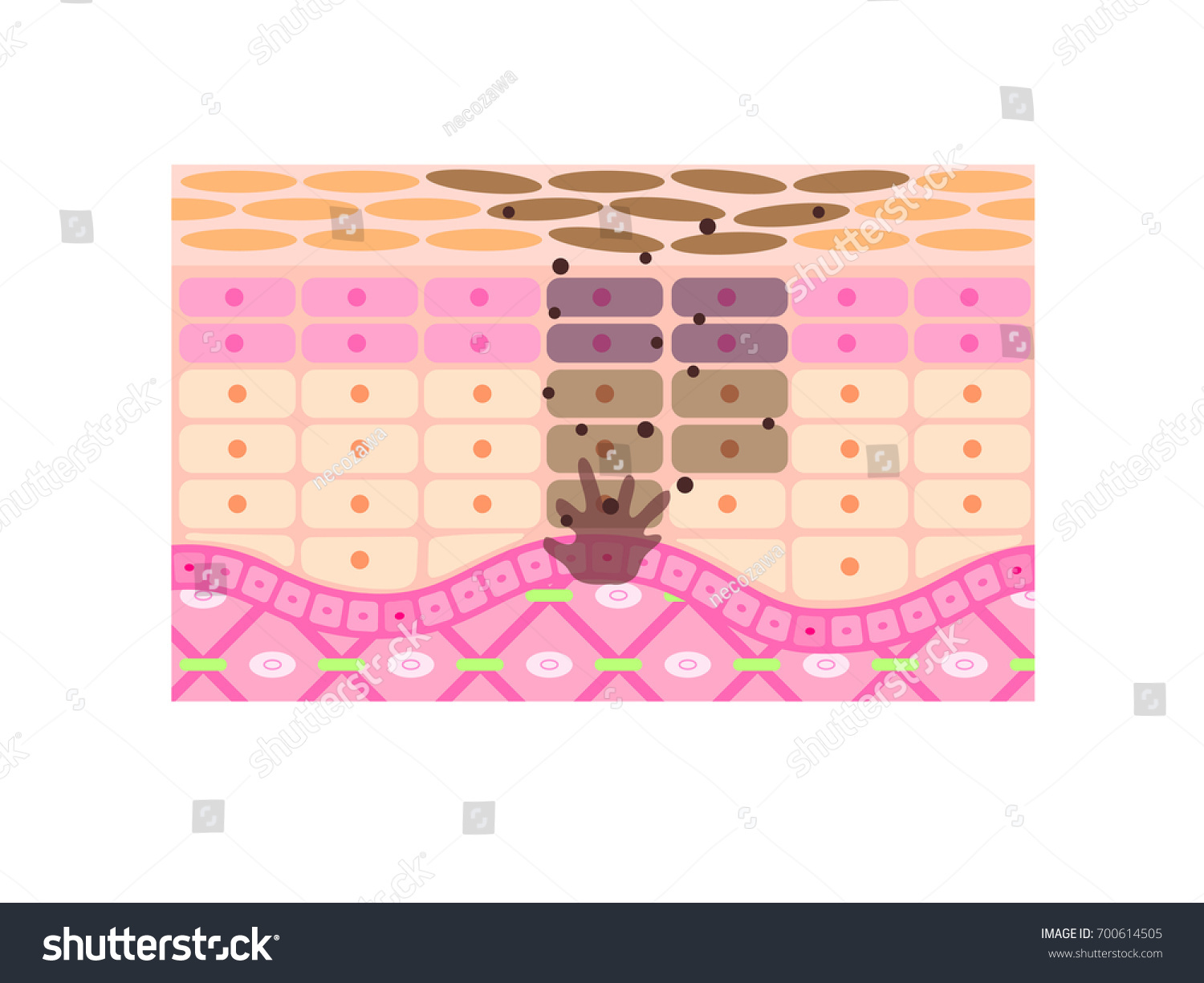 Mechanism Skin Stain Illustration Stock Vector (Royalty Free) 700614505