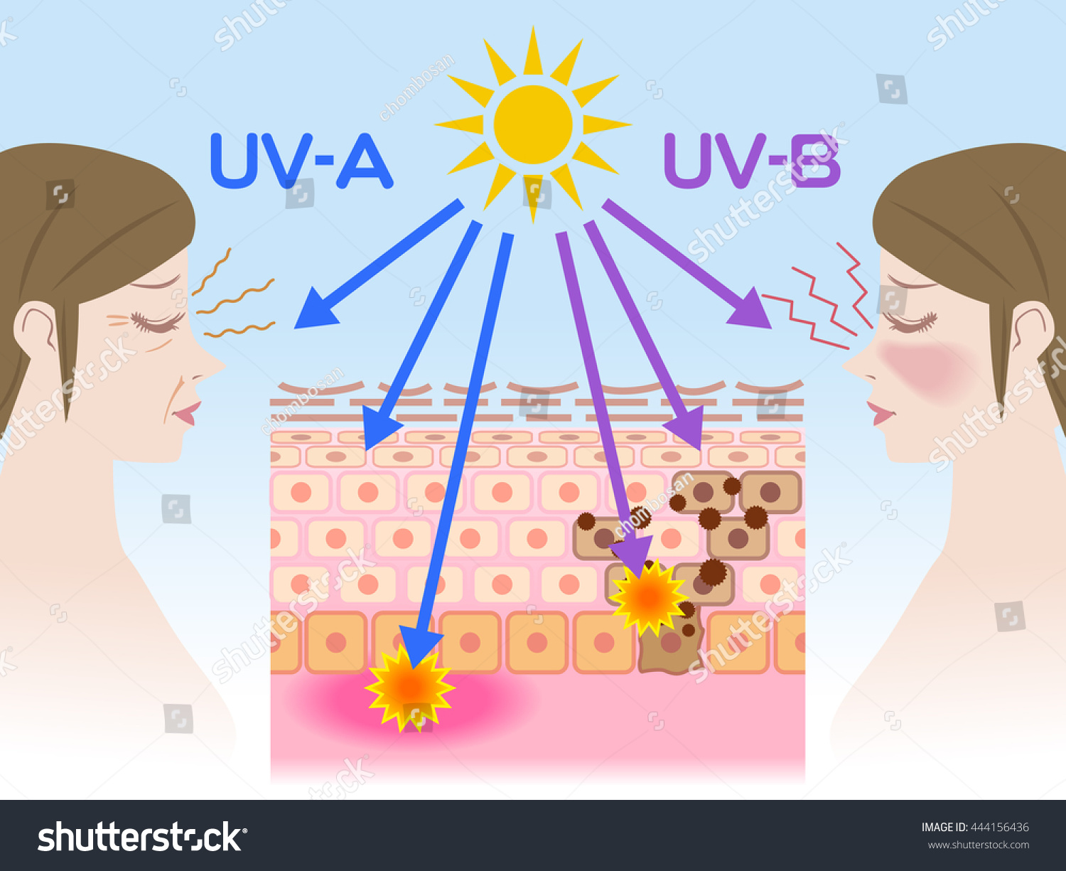 Mechanism Sunburn Aging Skin Stock Vector 444156436 - Shutterstock