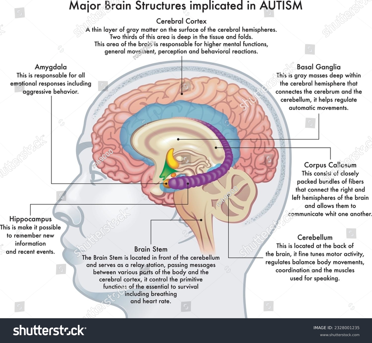 SVG of Medical illustration showing major brain structures implicated in autism spectrum disorder, with annotations. svg