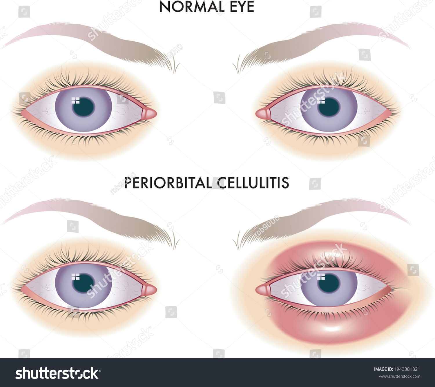 Orbit eye Images, Stock Photos & Vectors Shutterstock