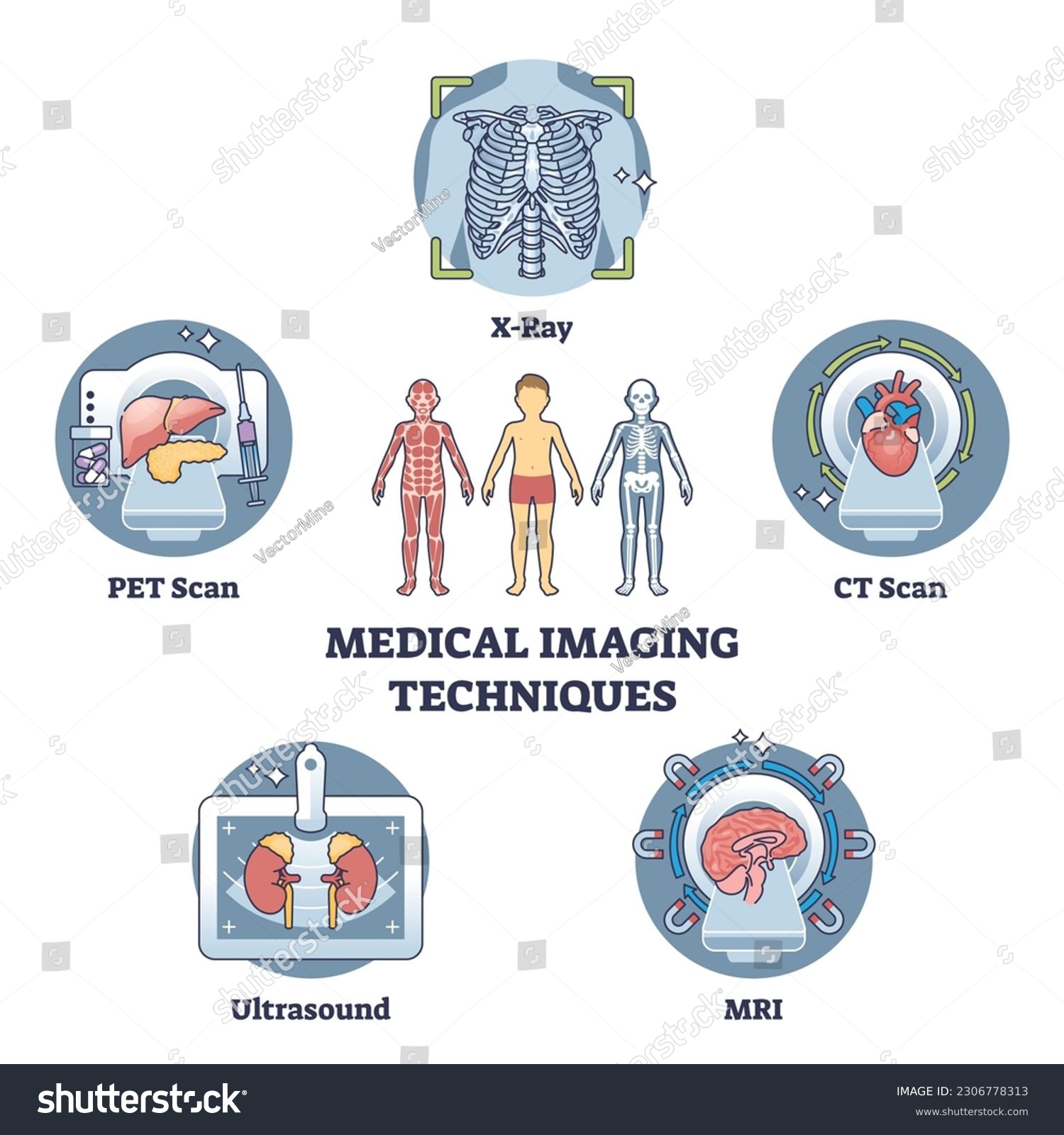 SVG of Medical imaging techniques for medical body diagnostics outline diagram. Labeled educational scheme with types for bones or organs inner examination vector illustration. X-ray, CT scan or MRI record. svg
