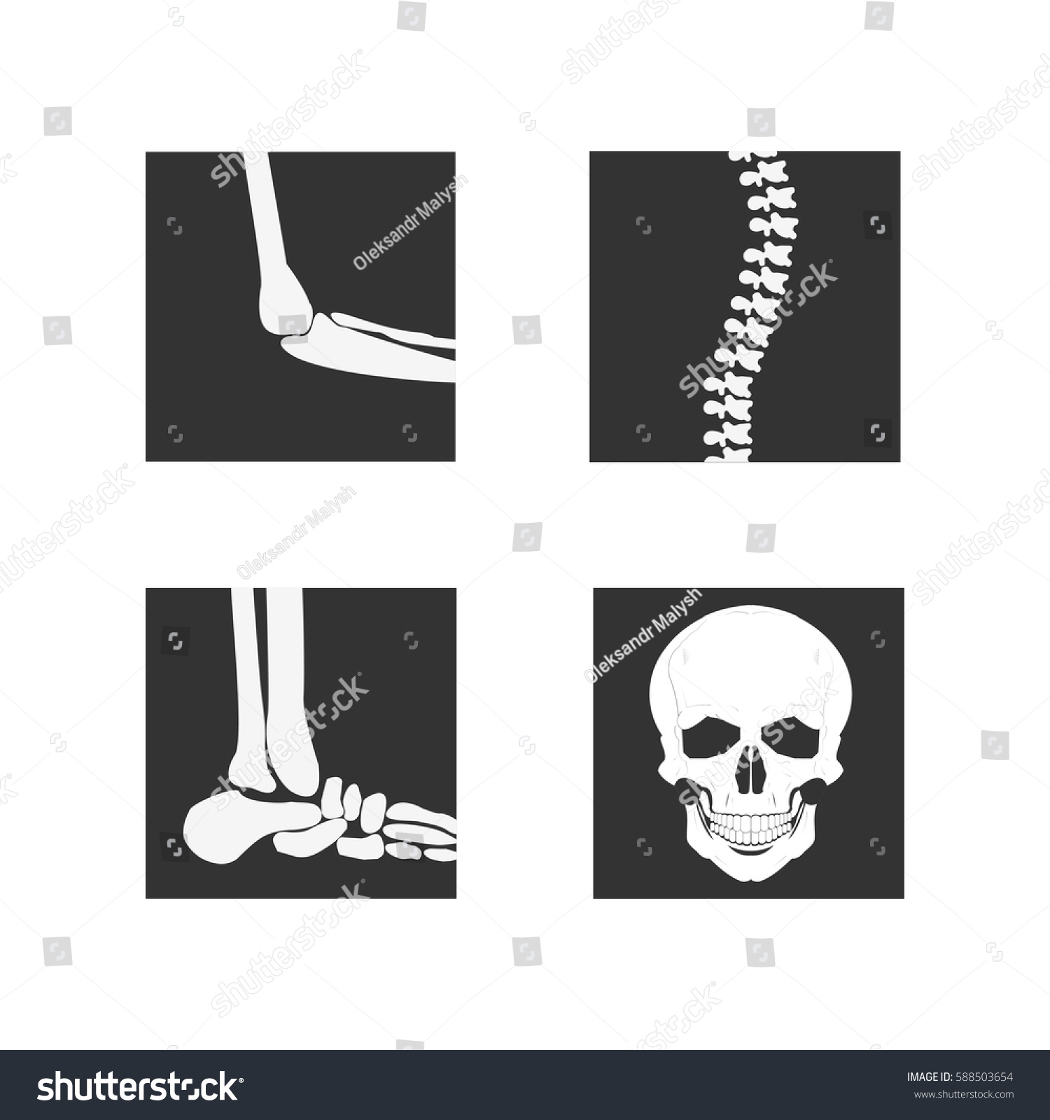Medical Orthopedic Set Anatomy Human Joint Stock Vector (Royalty Free ...